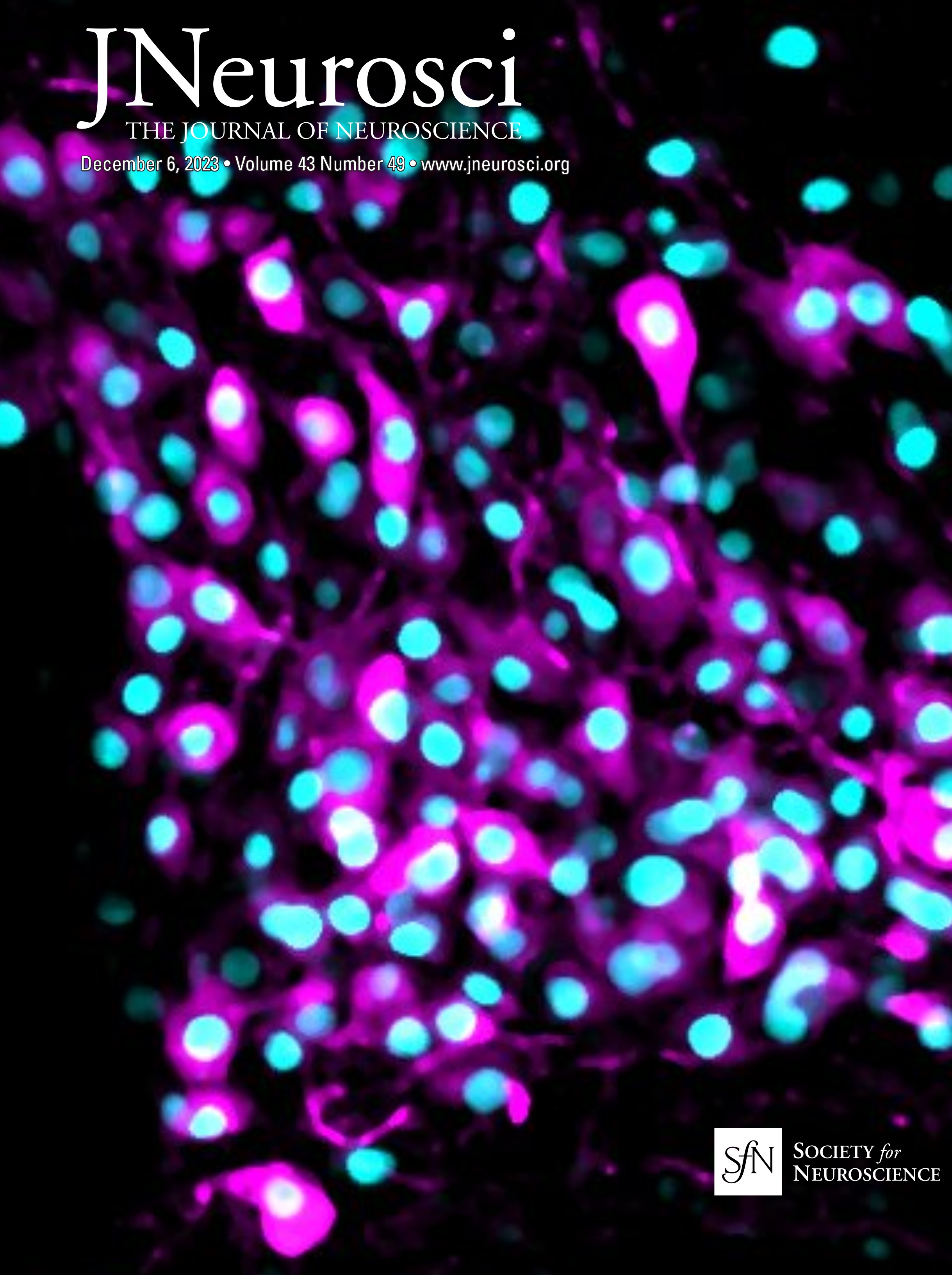 Distinct Neural Components of Visually Guided Grasping during Planning and Execution