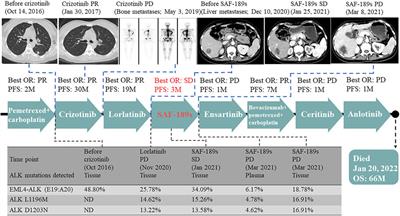 Case report: SAF-189s is a potent inhibitor in a lorlatinib-resistant NSCLC patient with acquired compound mutations ALK L1196M and D1203N