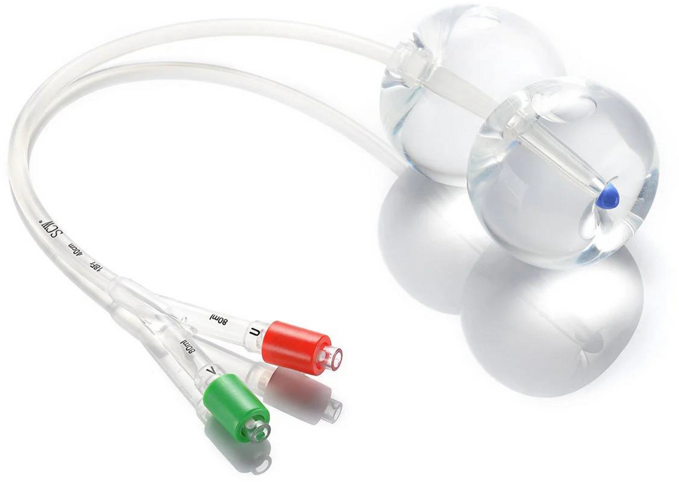 Cesarean Scar Pregnancy: Results of Treatment Using a Double-Balloon Cervical Ripening Catheter