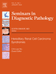 Contributions of Dr. Wick to the pathology of diseases of the lung and pleura