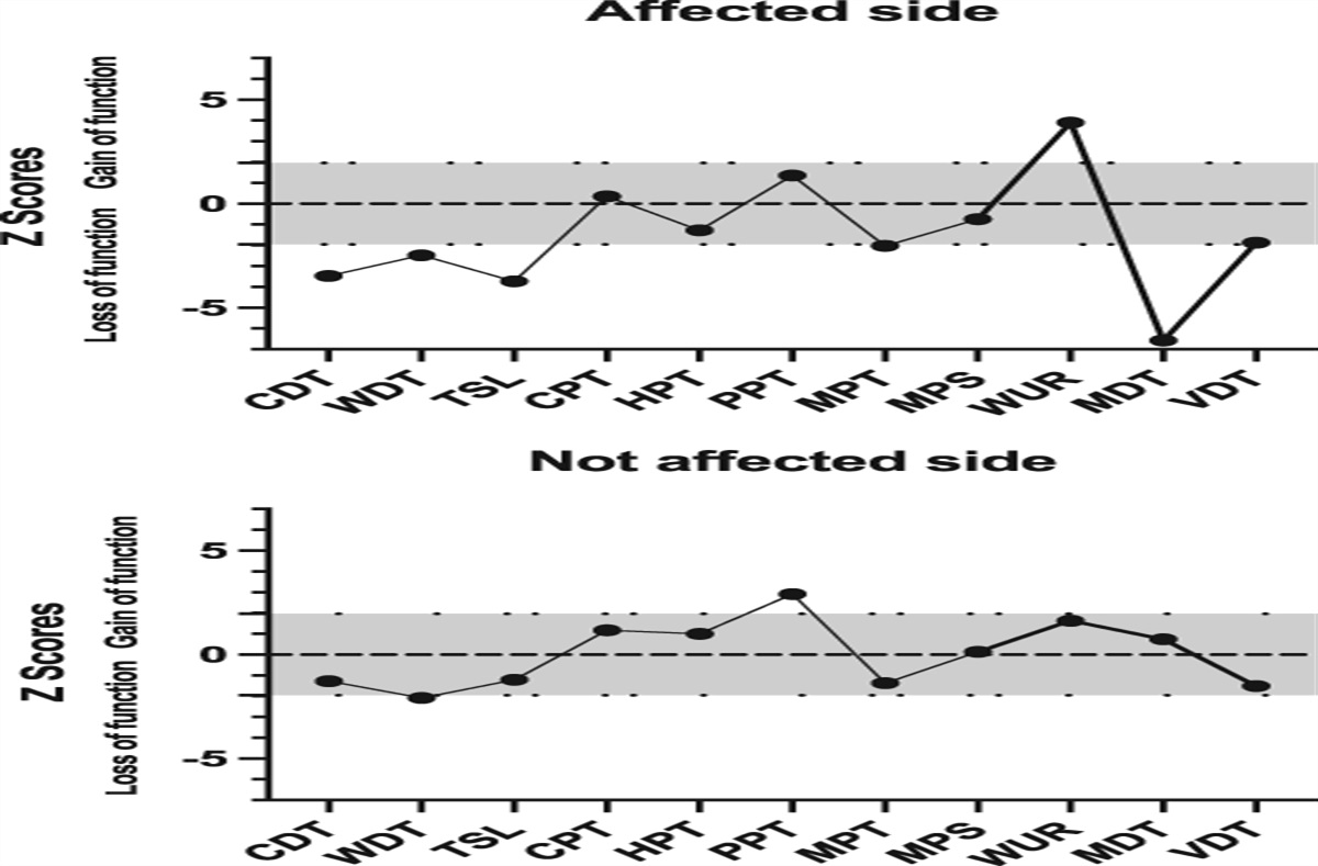 Trigeminal neuropathy presenting secondary to SARS-CoV-2 infection
