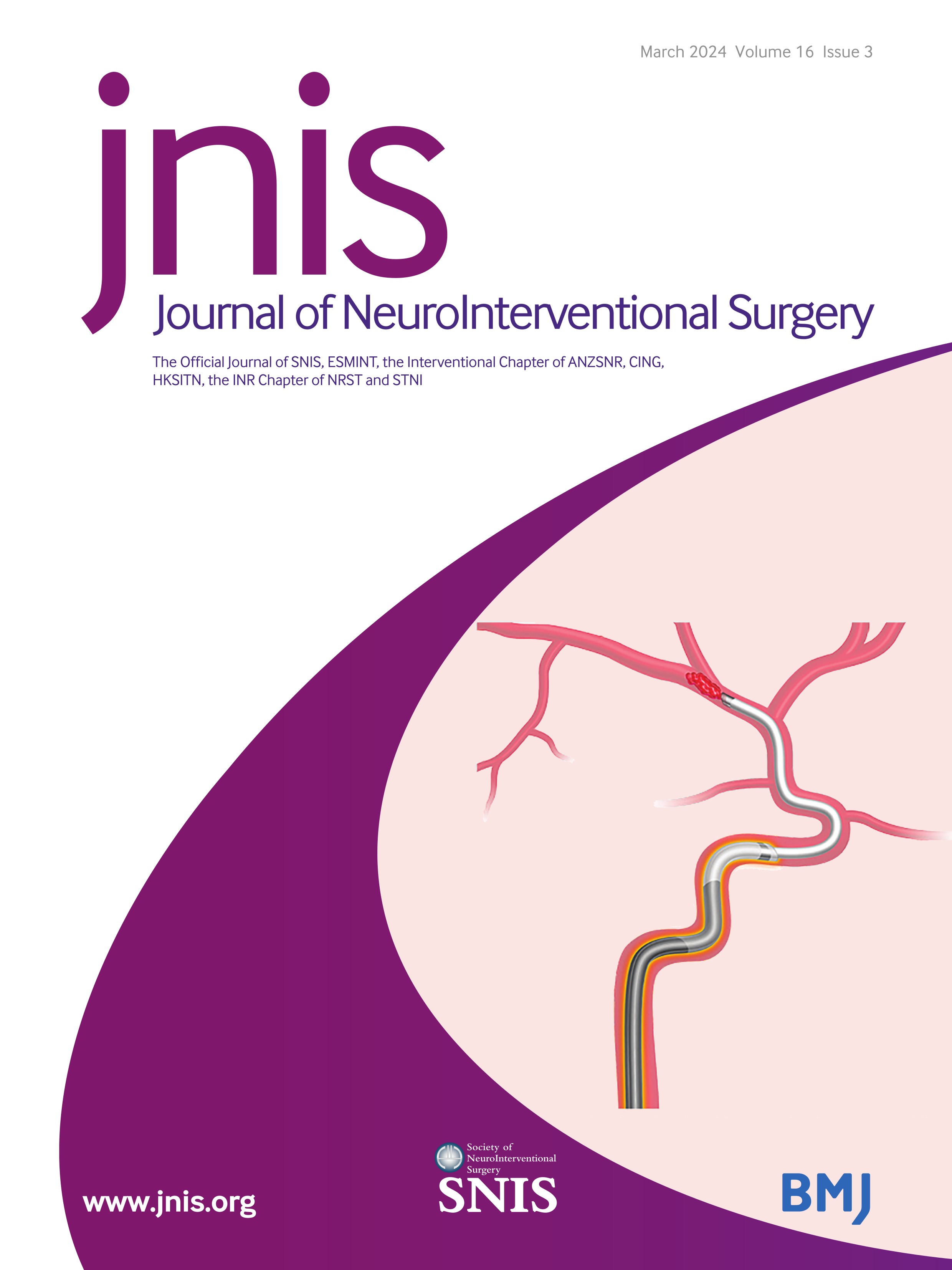 In vitro comparison of middle meningeal artery embolization with Squid liquid embolic agent and Contour polyvinyl alcohol particles