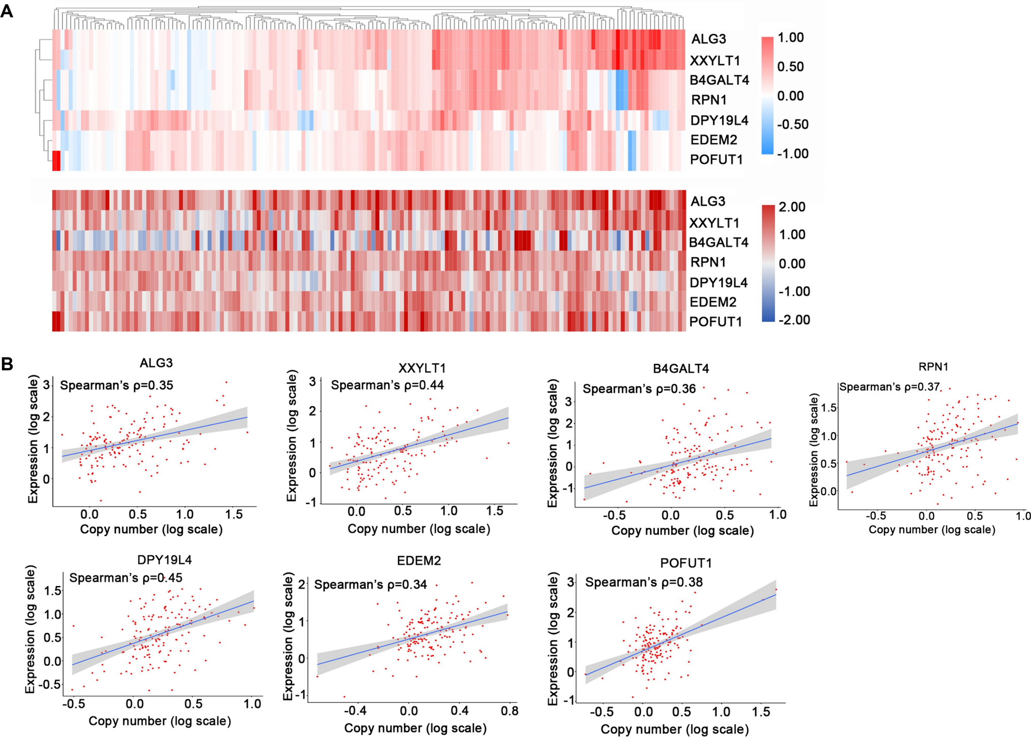 The glycogene alterations and potential effects in esophageal squamous cell carcinoma