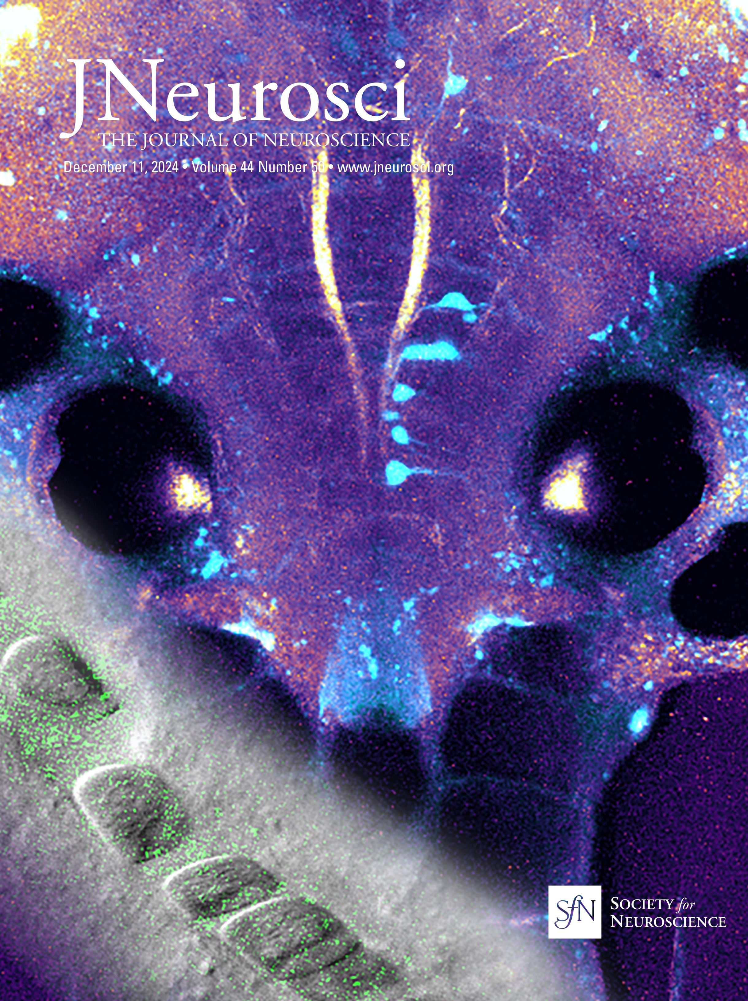 Defects in Exosome Biogenesis Are Associated with Sensorimotor Defects in Zebrafish vps4a Mutants