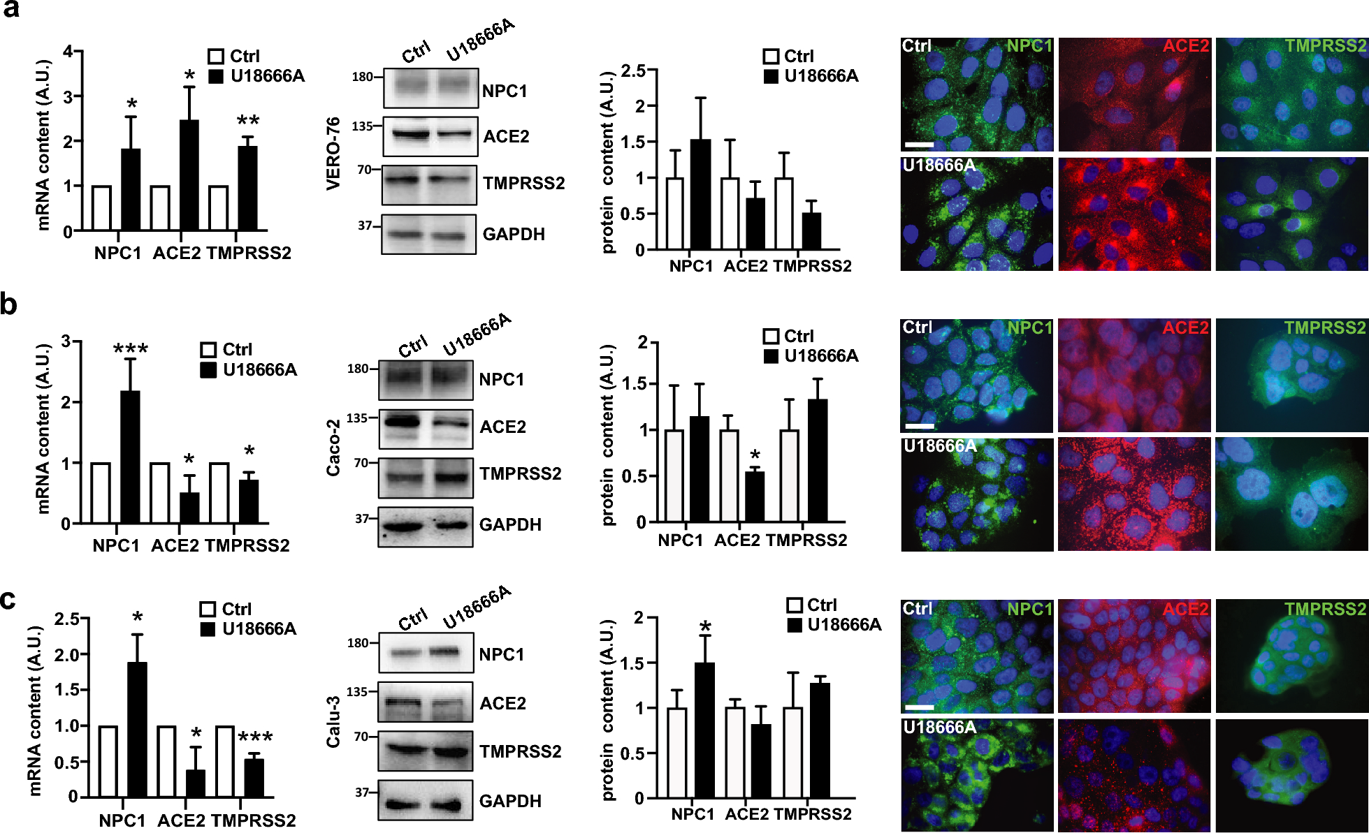 The inactivation of the Niemann Pick C1 cholesterol transporter restricts SARS-CoV-2 entry into host cells by decreasing ACE2 abundance at the plasma membrane