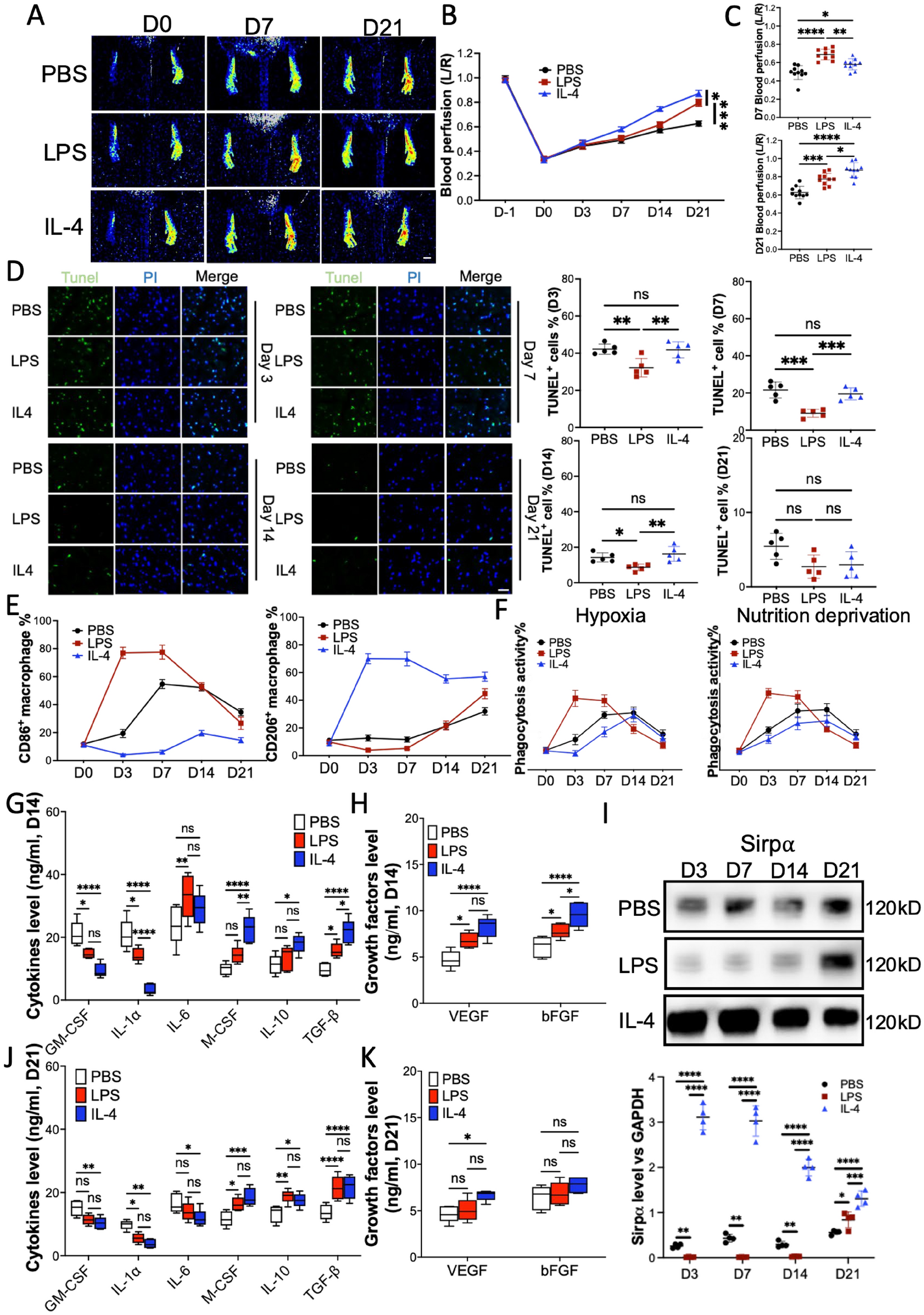 Signal regulatory protein α dynamically mediates macrophage polarization facilitated alleviation of ischemic diseases