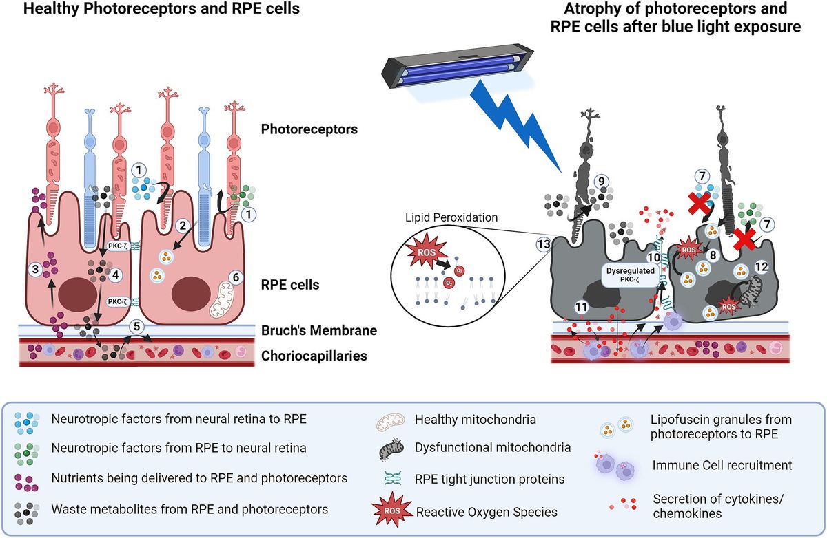 Blue light-induced phototoxicity in retinal cells: implications in age-related macular degeneration