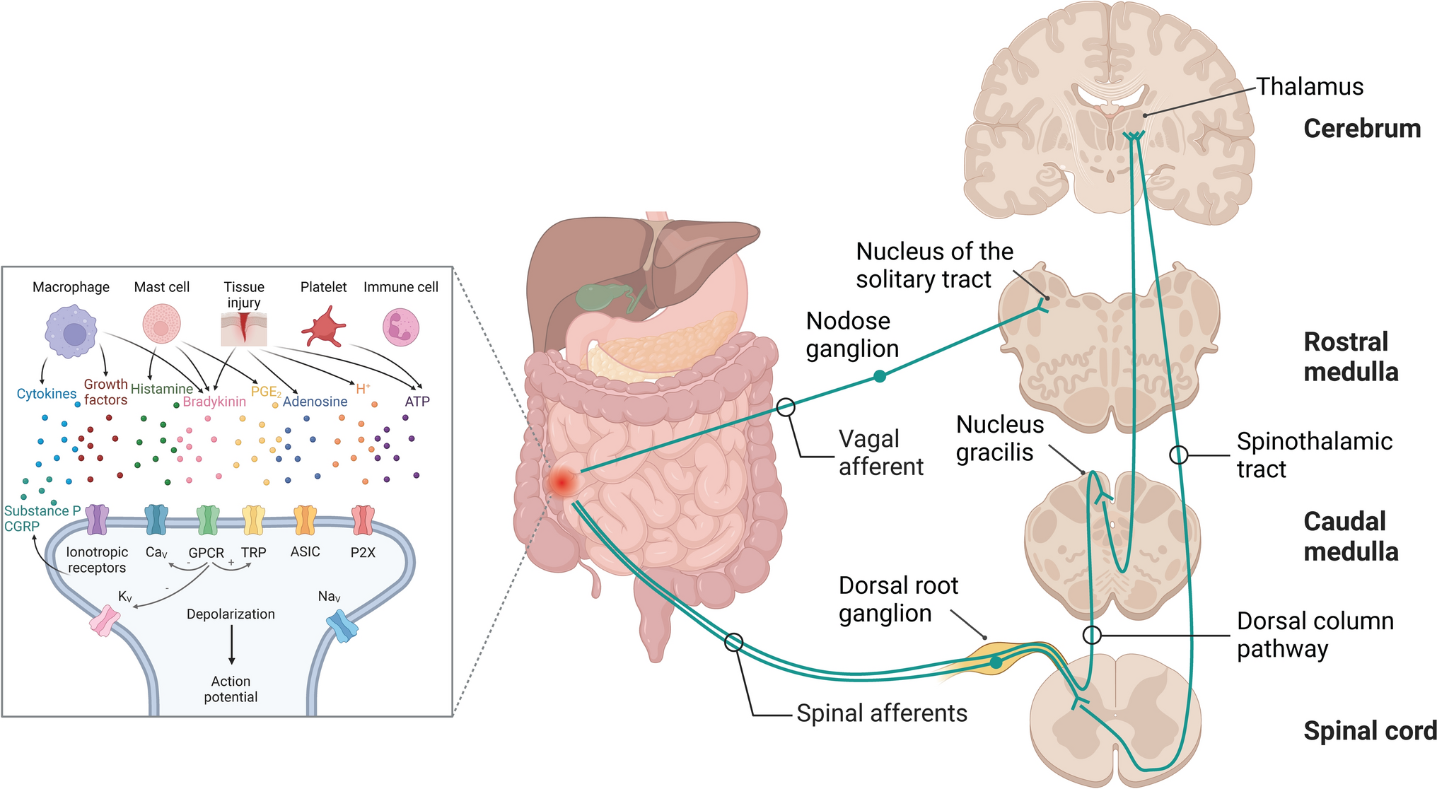 Visceral Pain in Preterm Infants with Necrotizing Enterocolitis: Underlying Mechanisms and Implications for Treatment