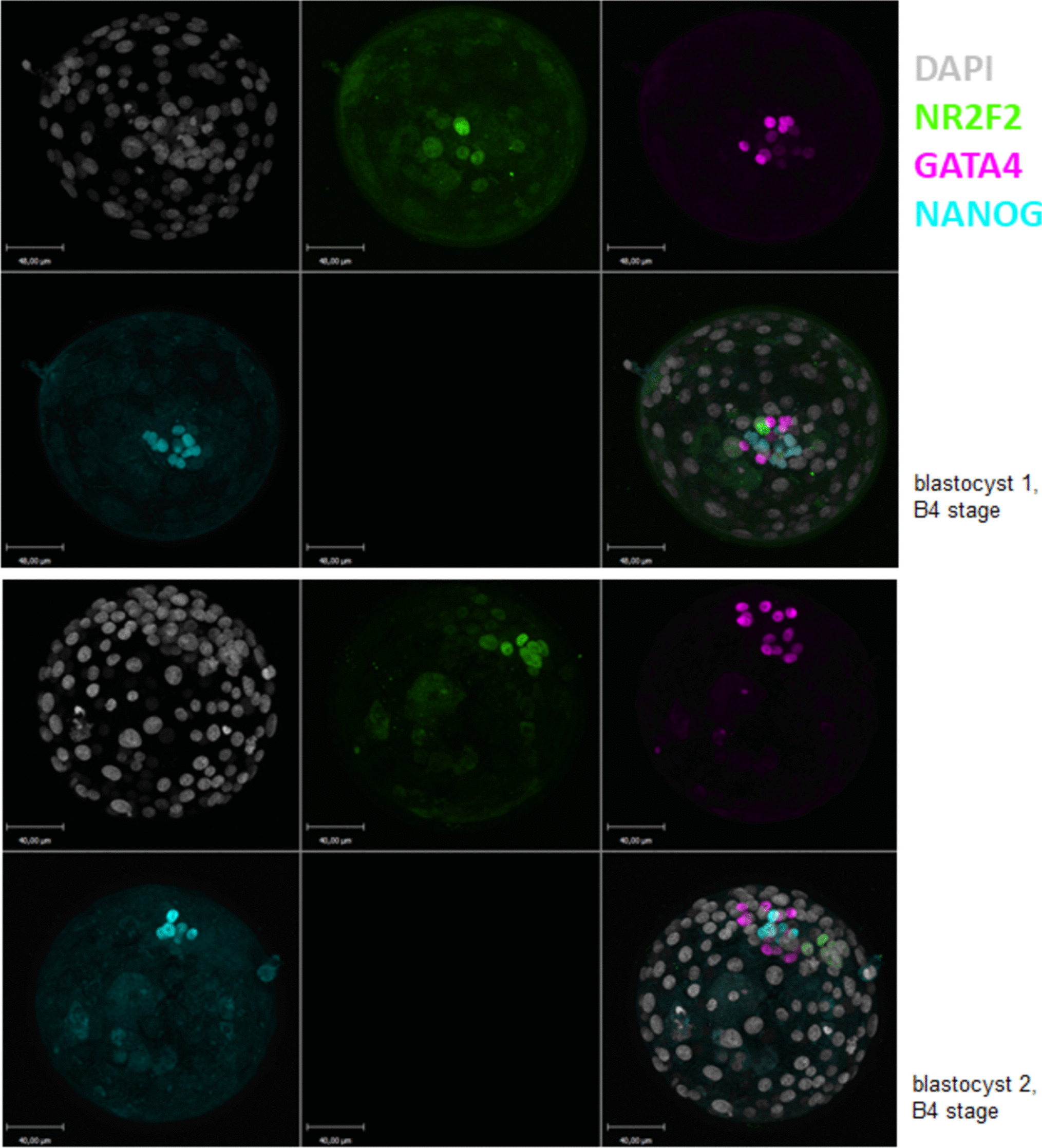 Ultra-Fast Warming Procedure of Vitrified Blastocysts Results in Maintained Embryology and Clinical Outcomes