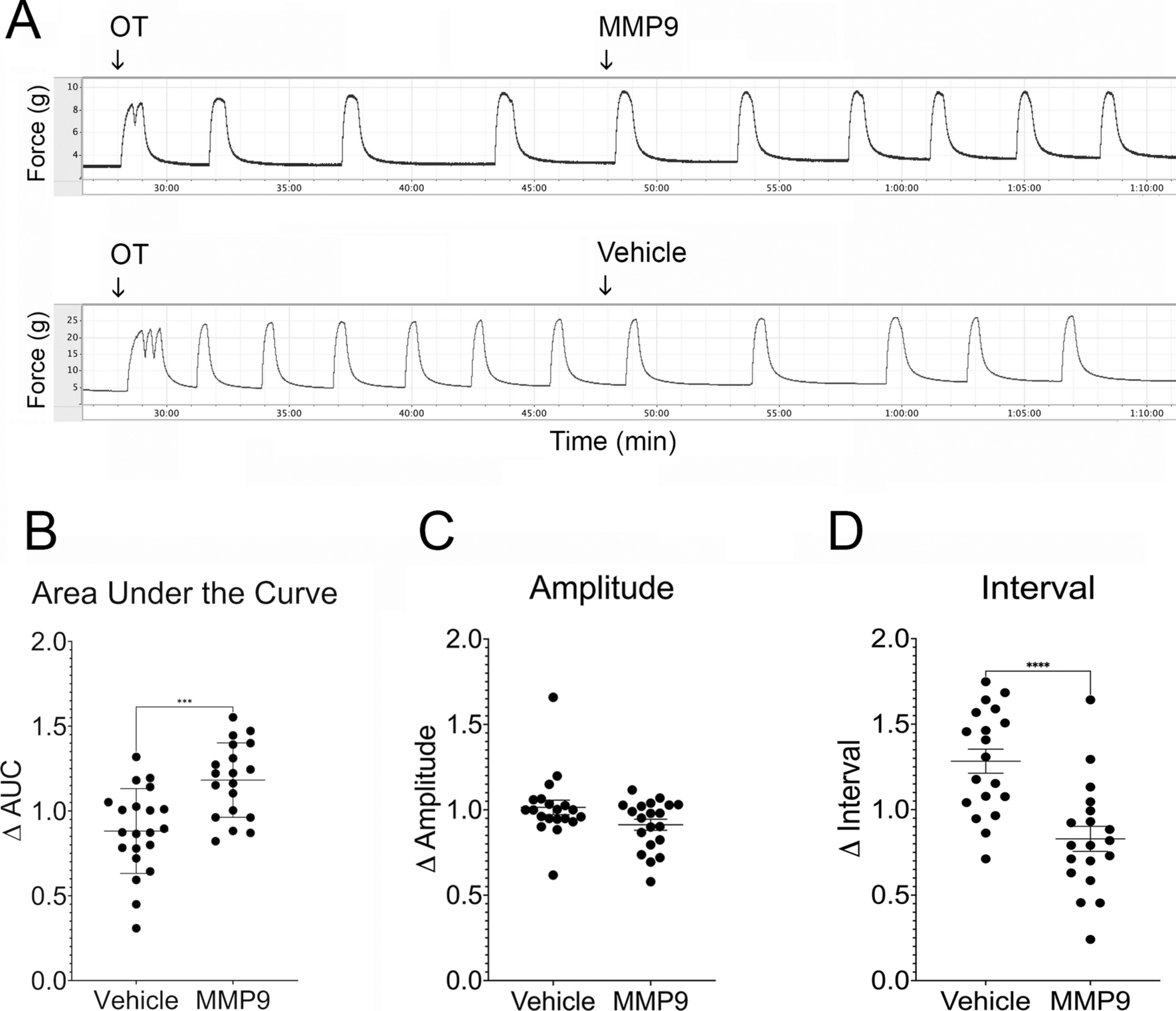 Matrix Metallopeptidase 9 Promotes Contraction in Human Uterine Myometrium