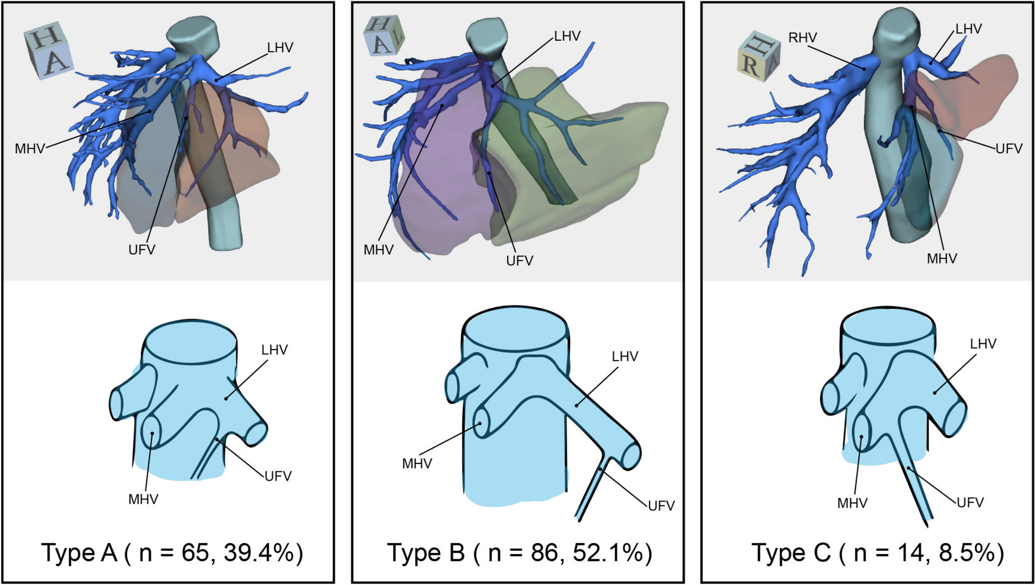 Comprehensive evaluation of the ramification patterns of hepatic vascular anatomy based on three-dimensional visualization technology