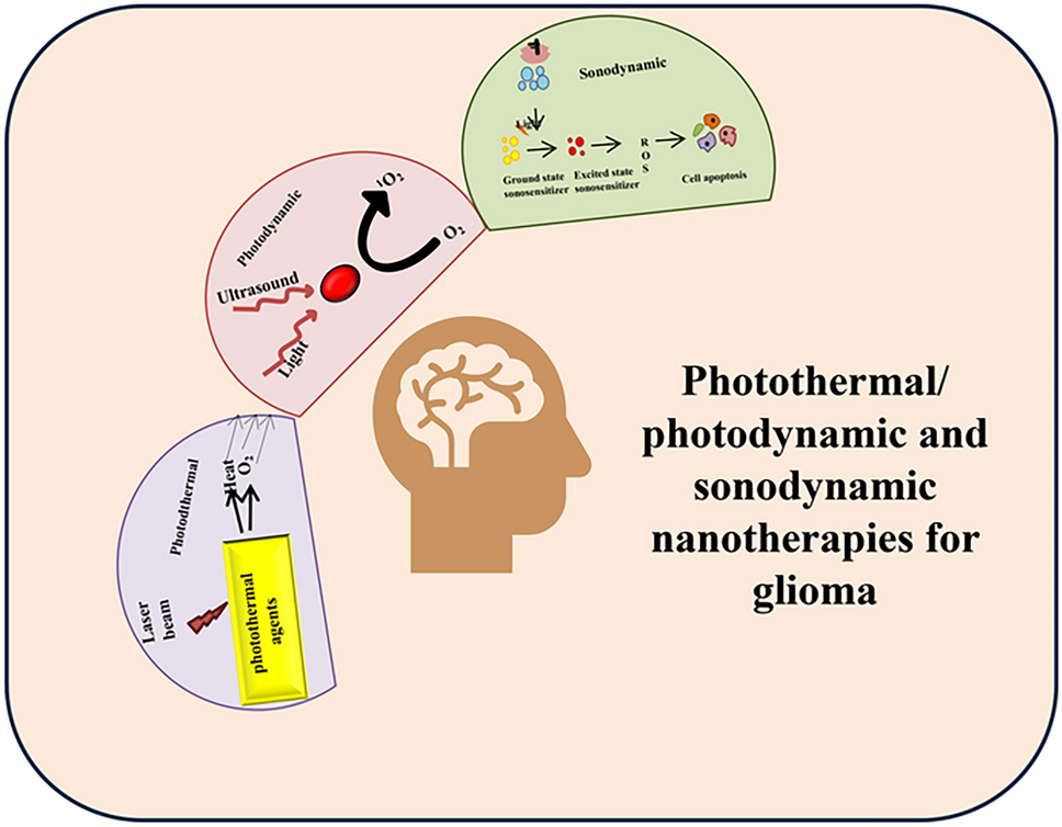 Emerging nanoplatforms towards microenvironment-responsive glioma therapy