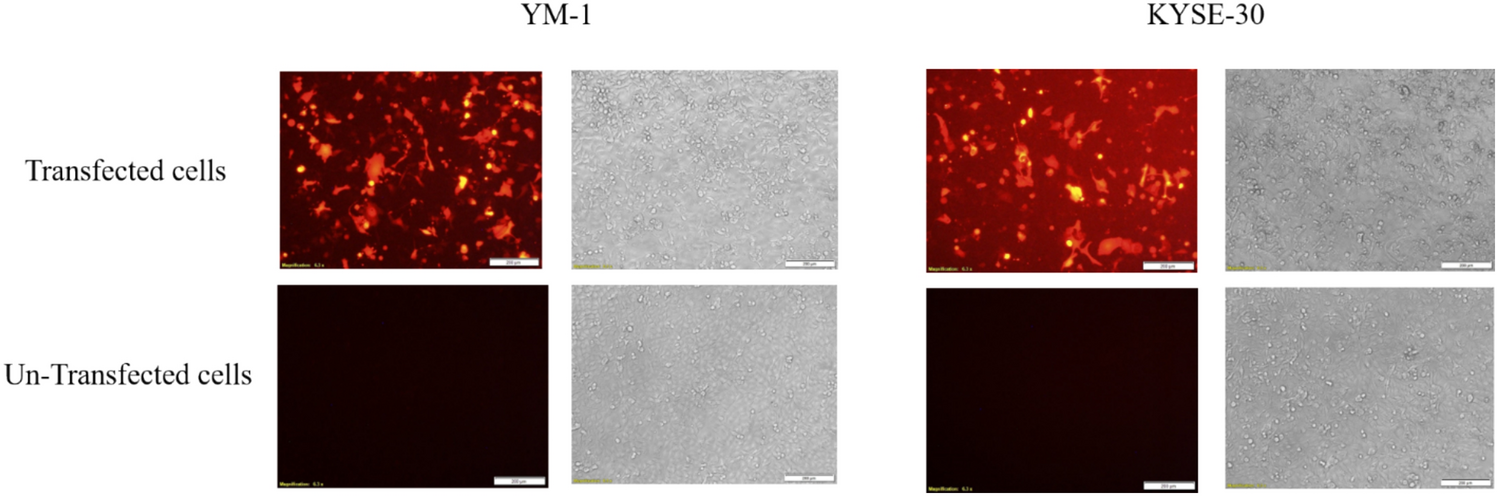 PYGO2 promotes resistance to chemotherapy via reducing apoptosis and G2/M cell cycle arrest in esophageal carcinoma cells