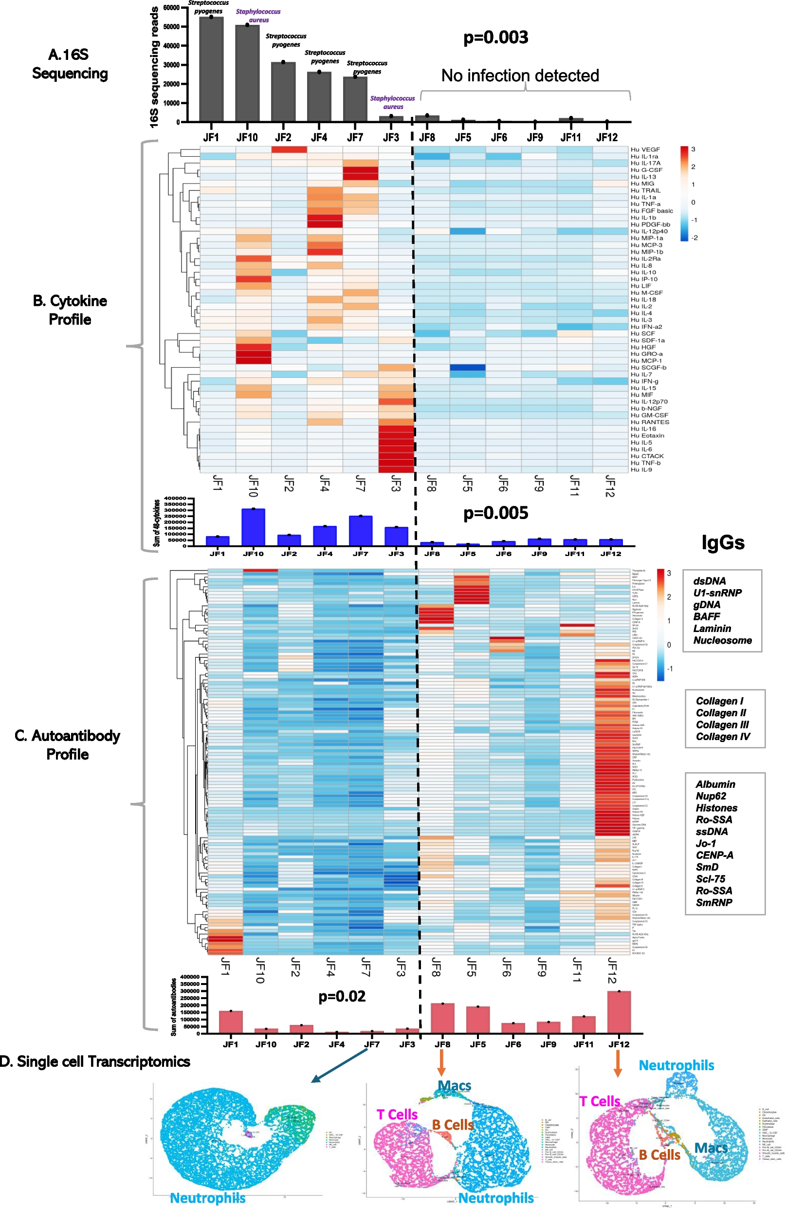 Joint fluid multi-omics improves diagnostic confidence during evaluation of children with presumed septic arthritis