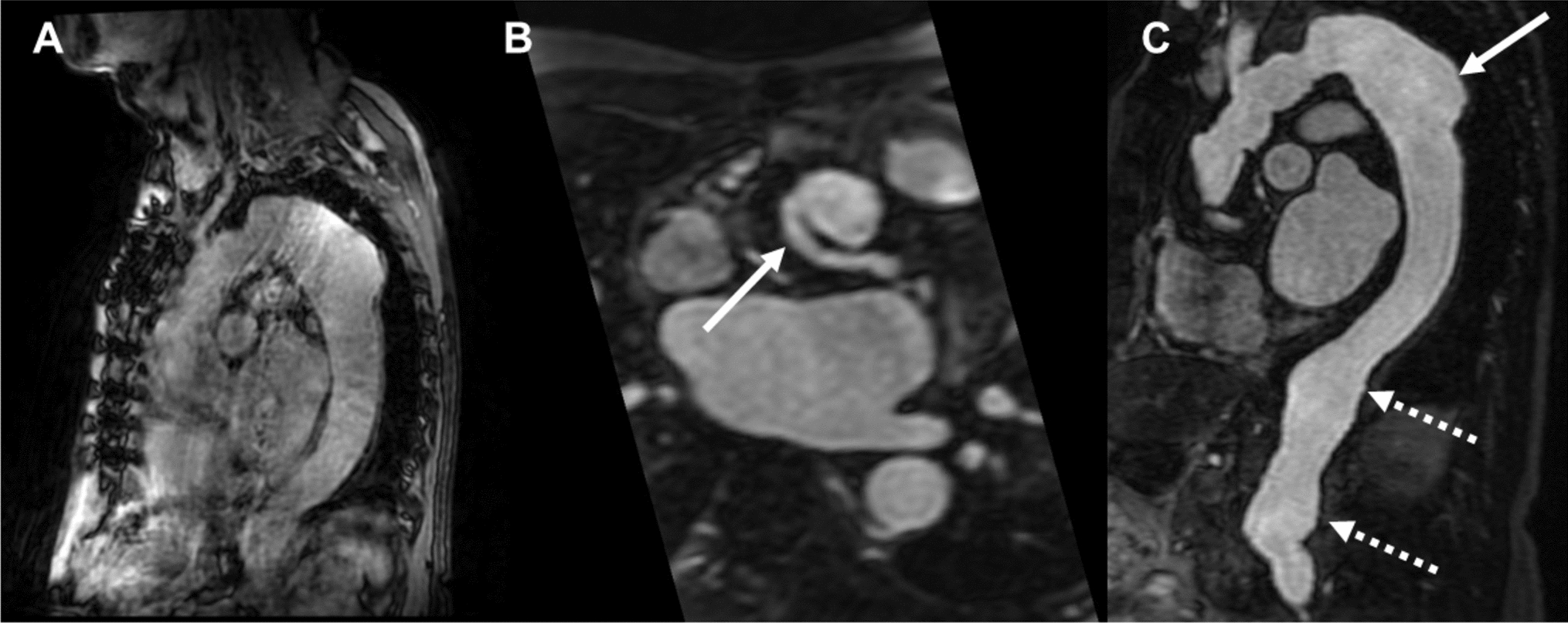 Selective use of ferumoxytol-enhanced magnetic resonance angiography in patients with renal insufficiency: insights from a pilot study