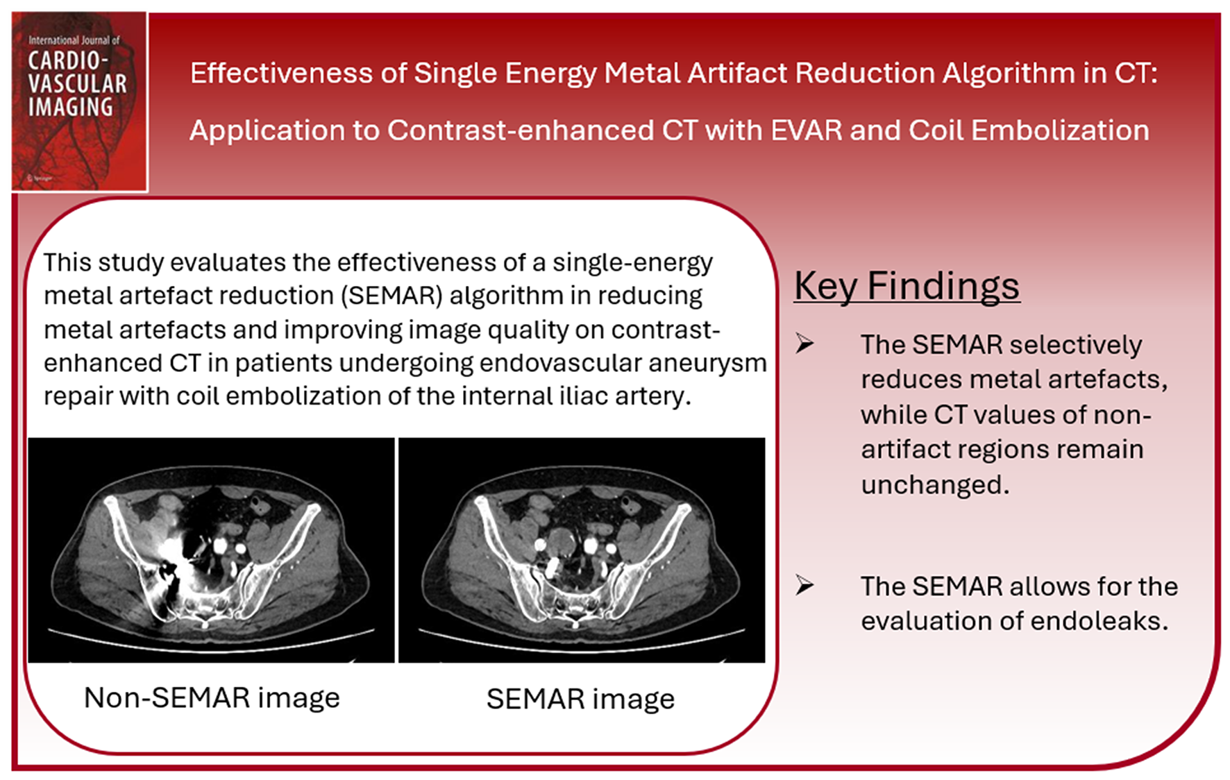 Effectiveness of single-energy metal artifact reduction algorithm in CT: application to contrast-enhanced CT with EVAR and coil embolization