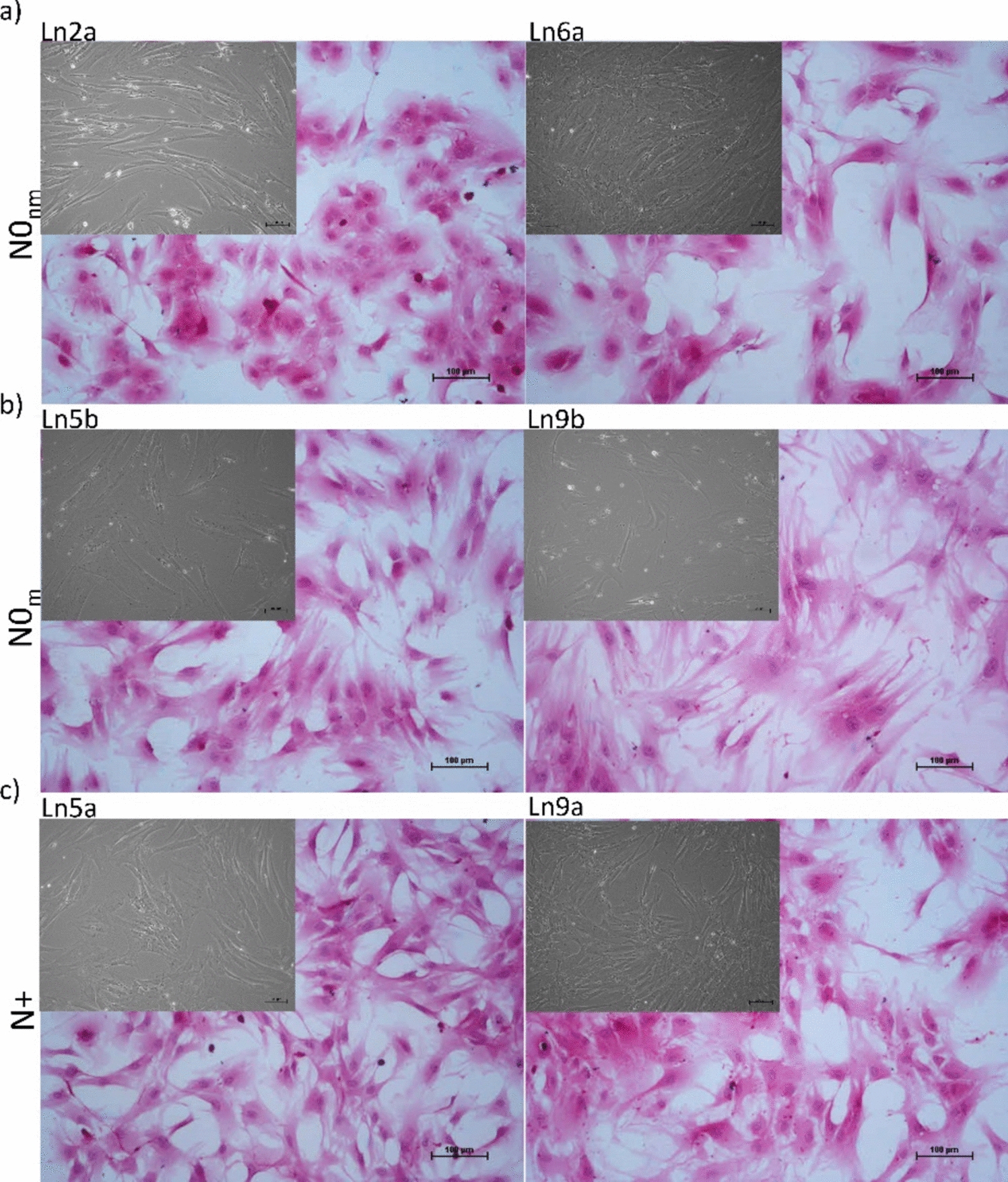 Modeling the lymph node stromal cells in oral squamous cell carcinoma: insights into the stromal cues in nodal metastasis