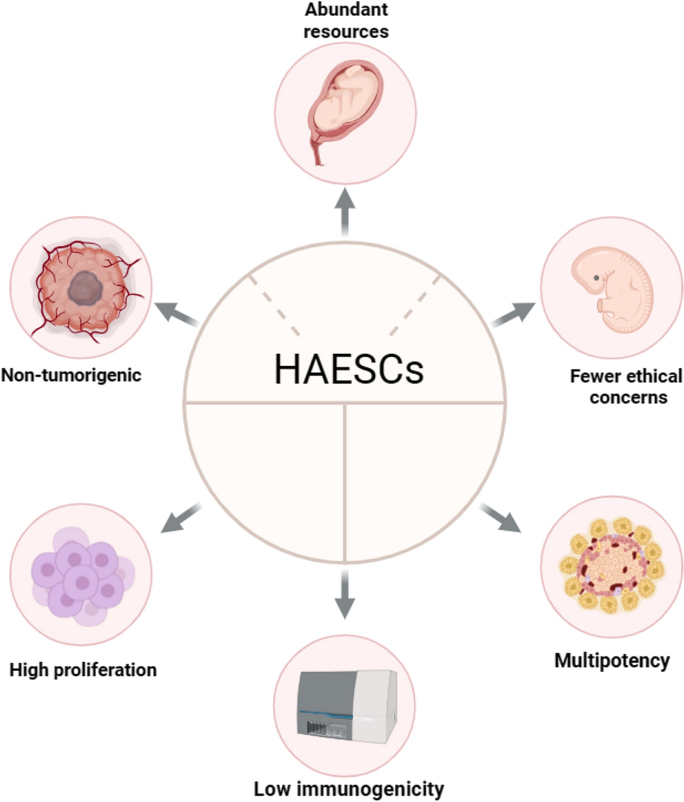 Human amniotic epithelial stem cells, a potential therapeutic approach for diabetes and its related complications