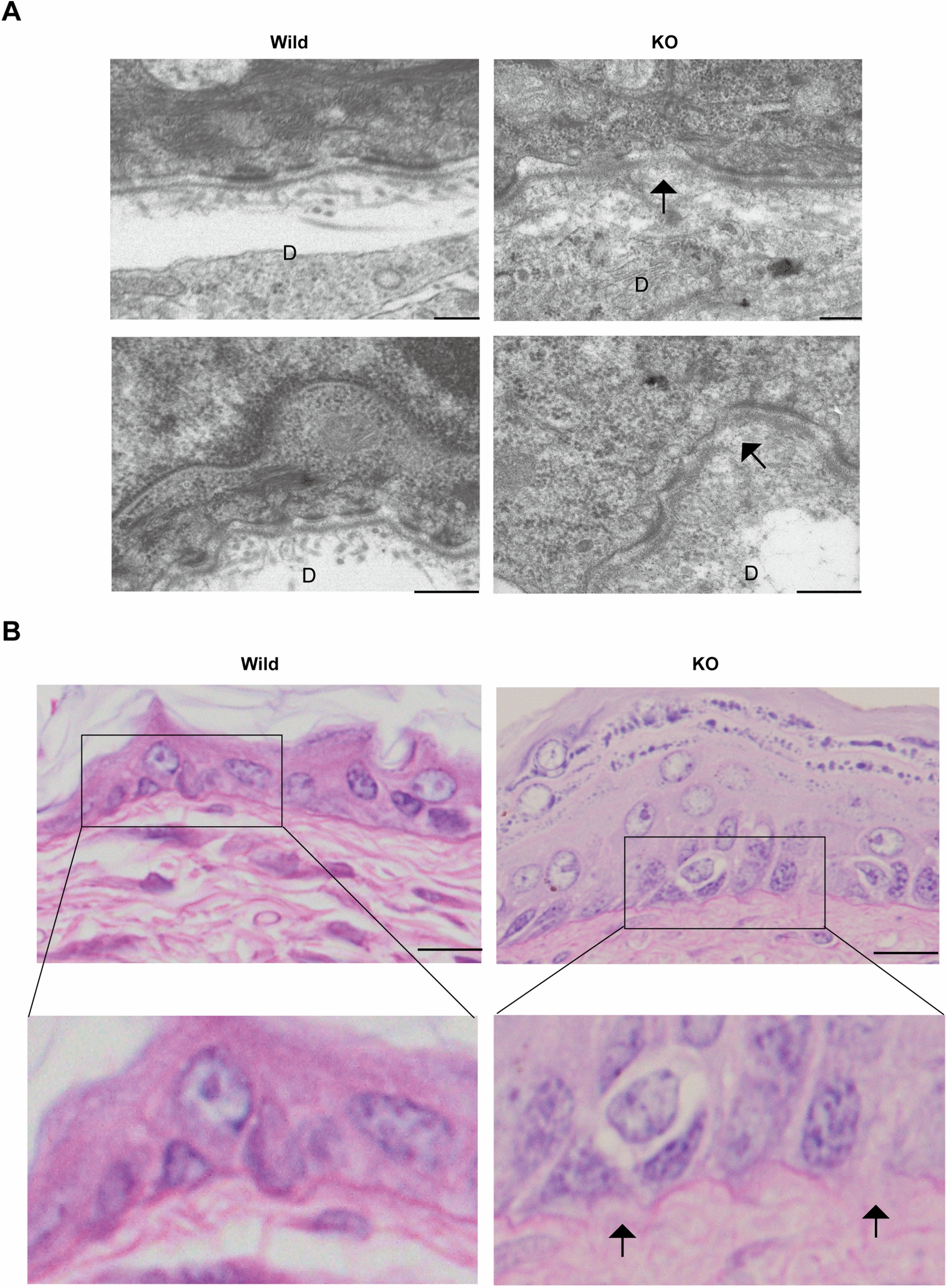Loss of hepatocyte growth factor activator inhibitor type 1 (HAI-1) upregulates MMP-9 expression and induces degradation of the epidermal basement membrane