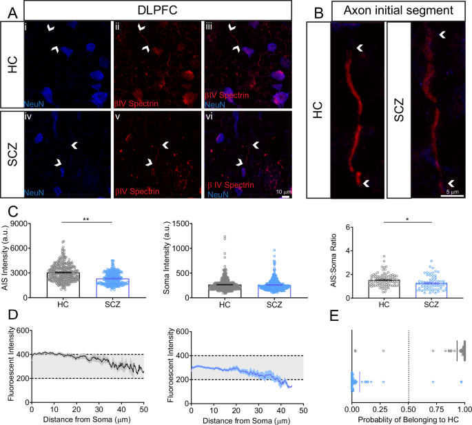 βIV spectrin abundancy, cellular distribution and sensitivity to AKT/GSK3 regulation in schizophrenia