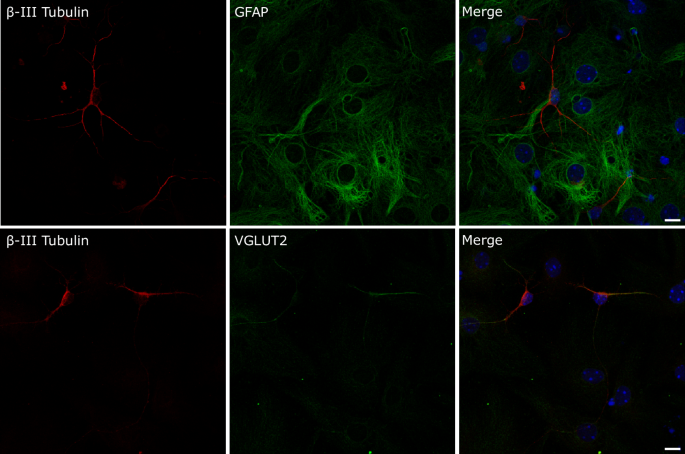 Maternal immune activation imprints translational dysregulation and differential MAP2 phosphorylation in descendant neural stem cells