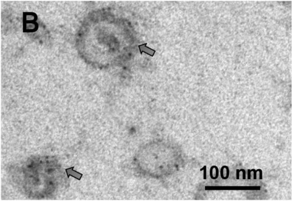 Correction: Exosomes derived from human exfoliated deciduous teeth ameliorate adult bone loss in mice through promoting osteogenesis