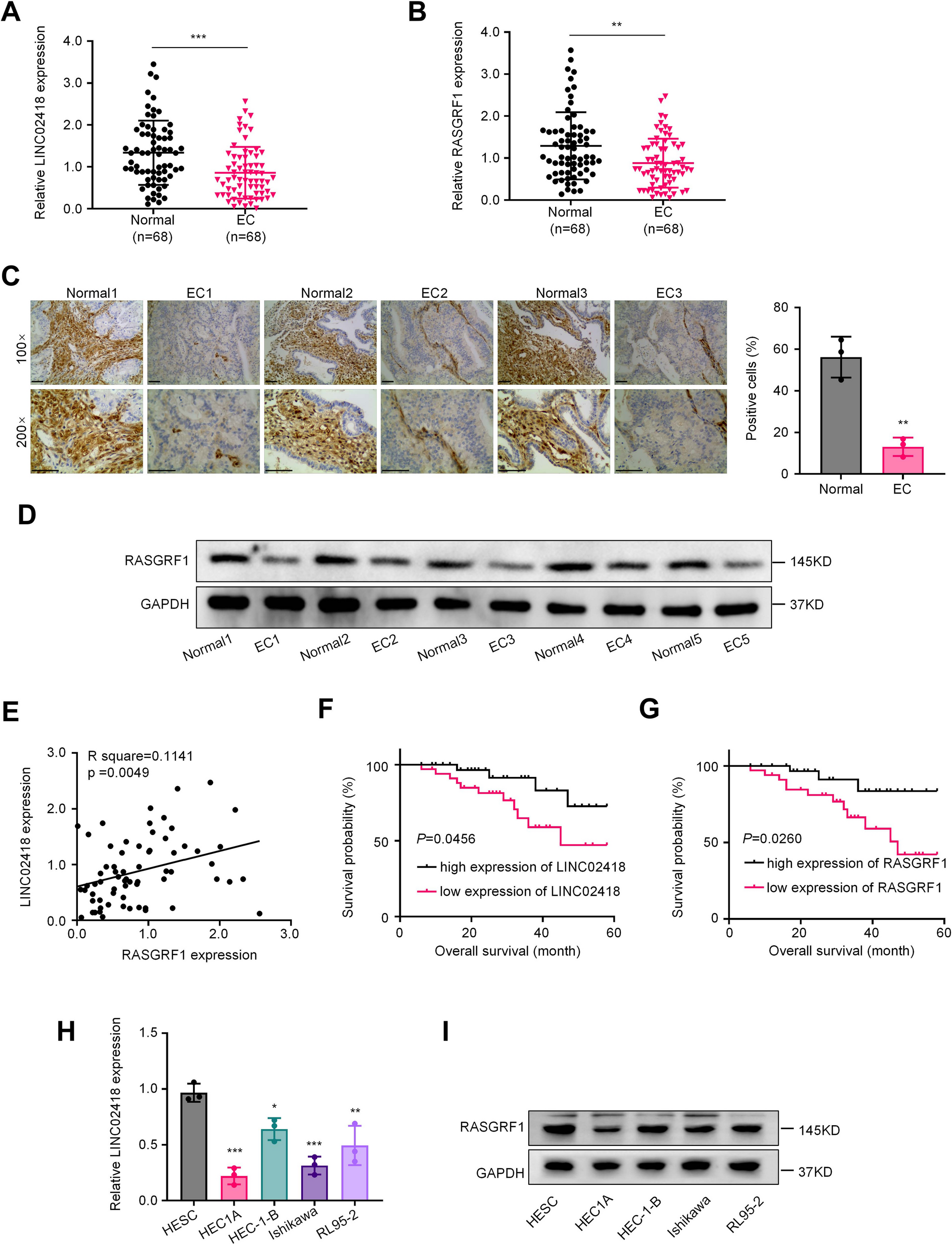 LINC02418 suppresses endometrial cancer progression via regulating miR-494-3p/RASGRF1 axis
