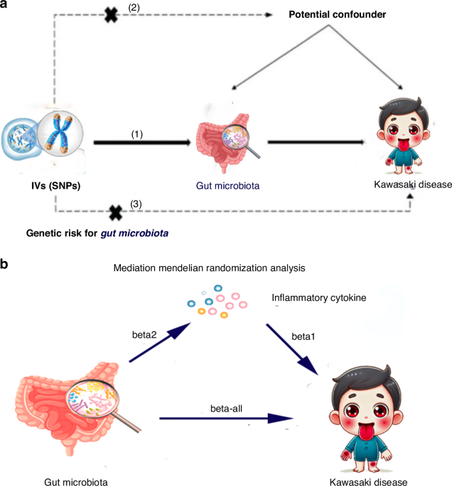 Gut microbiota, inflammatory cytokines, and Kawasaki disease: a Mendelian randomization study and mediation analysis