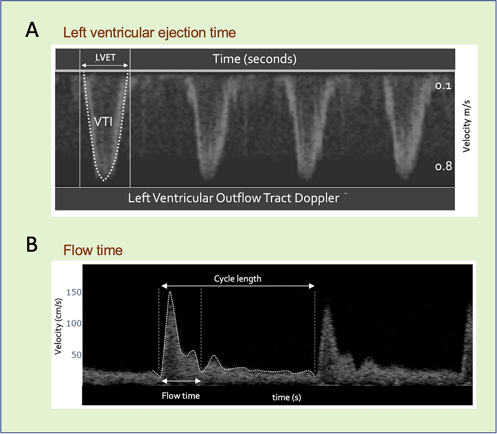 A framework for flow time measured by Doppler ultrasound