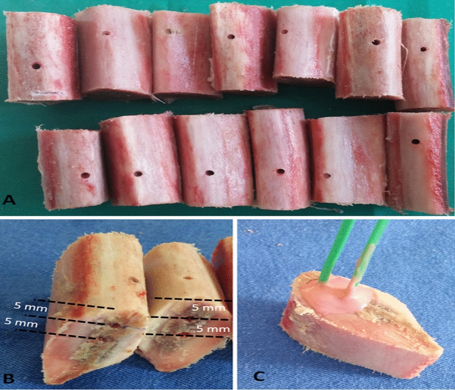 In-vitro investigation of bone temperature changes in osteotomies performed with different brands of implant burs