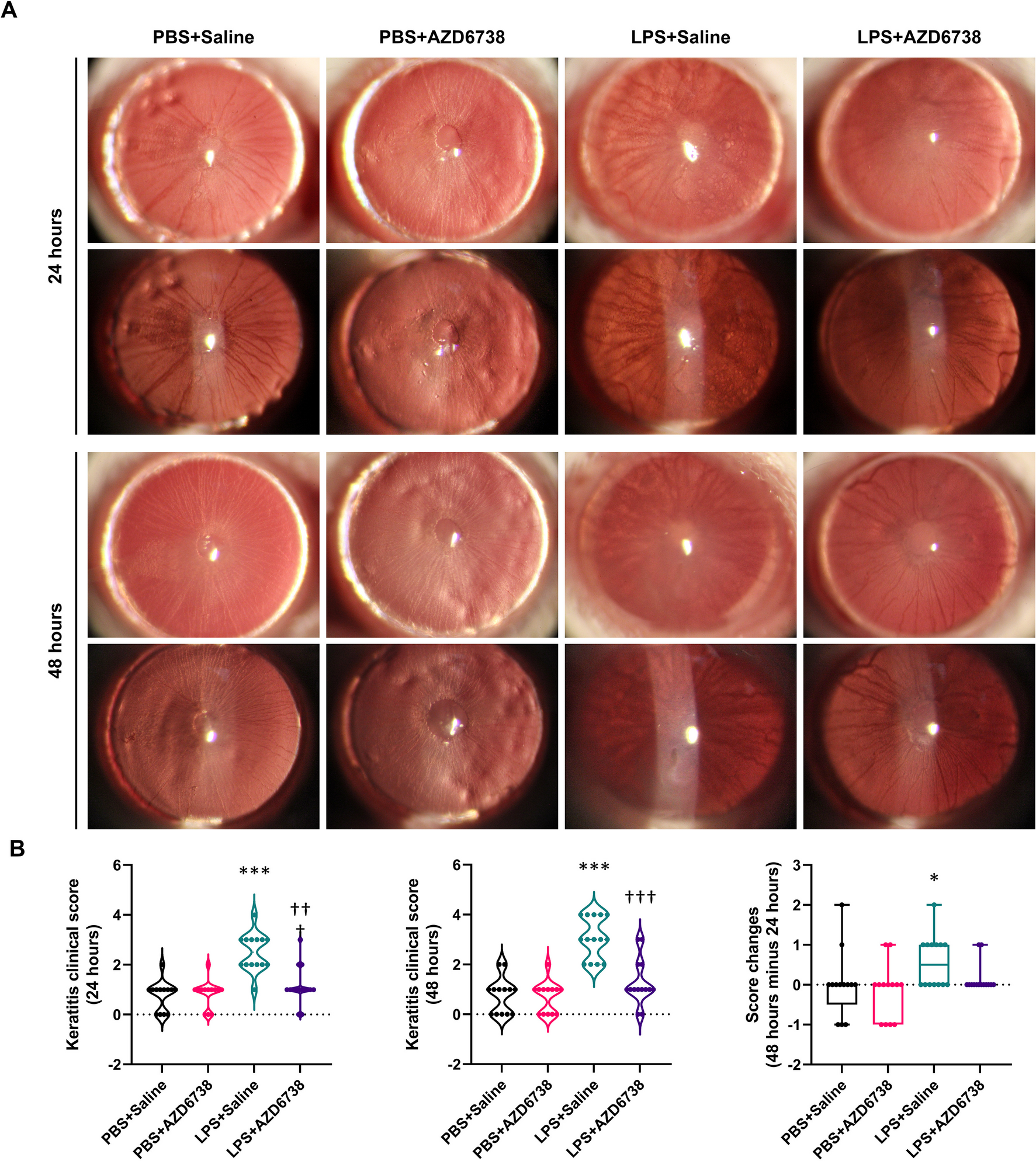 AZD6738 Attenuates LPS-Induced Corneal Inflammation and Fibrosis by Modulating Macrophage Function and Polarization