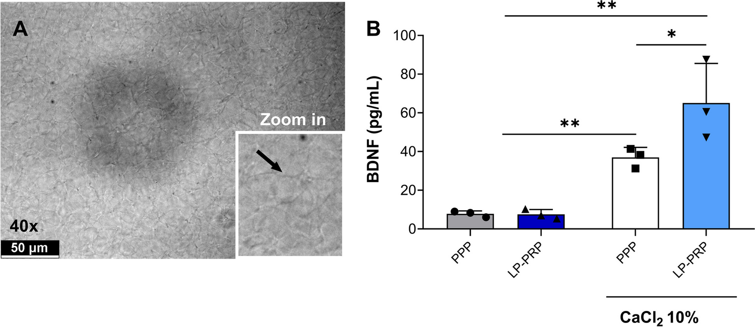 The Implications of Brain-Derived Neurotrophic Factor in the Biological Activities of Platelet-Rich Plasma