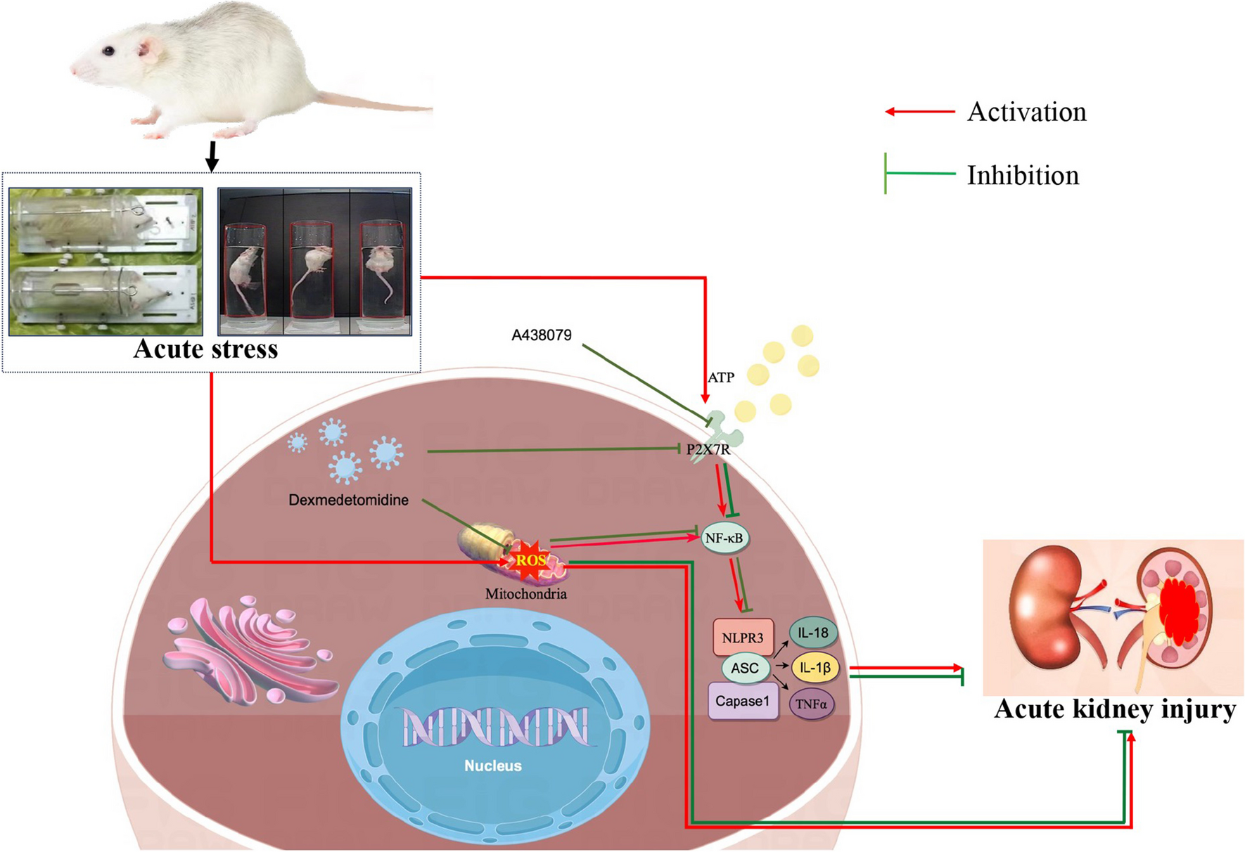 Dexmedetomidine Alleviates Acute Stress-Induced Acute Kidney Injury by Attenuating Inflammation and Oxidative Stress via Inhibiting the P2X7R/NF-κB/NLRP3 Pathway in Rats