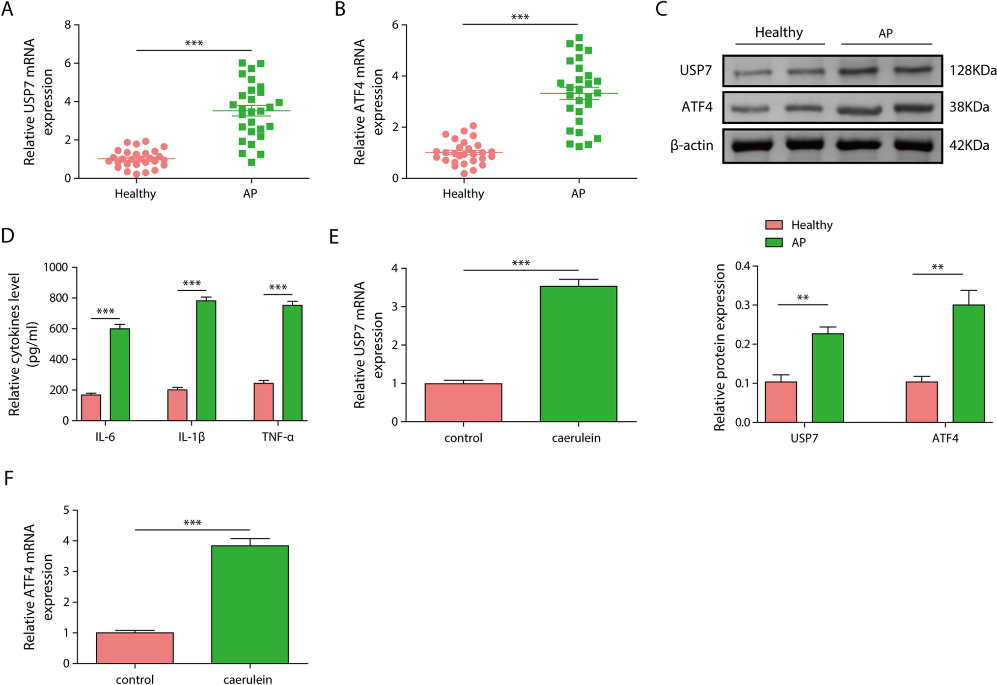 Ubiquitin-specific protease 7 exacerbates acute pancreatitis progression by enhancing ATF4-mediated autophagy