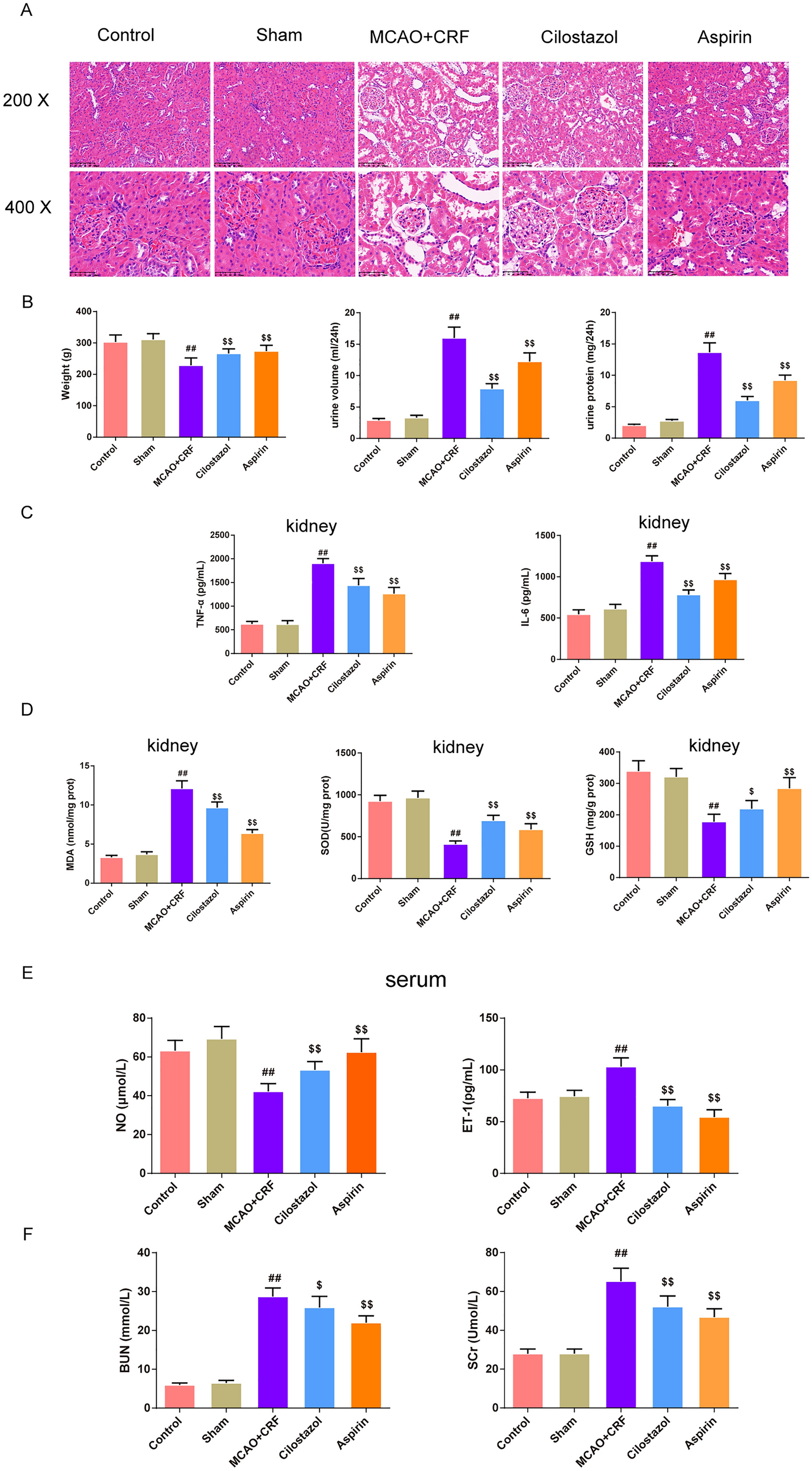 Protective effect of cilostazol on vascular injury in rats with acute ischemic stroke complicated with chronic renal failure