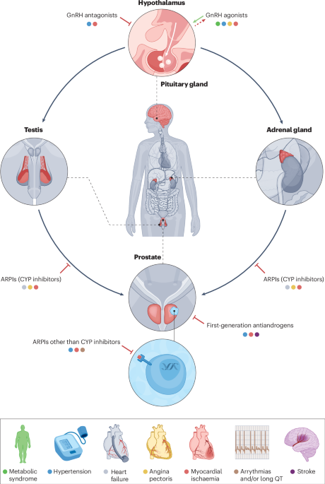 Assessing the effects of prostate cancer therapies on cardiovascular health