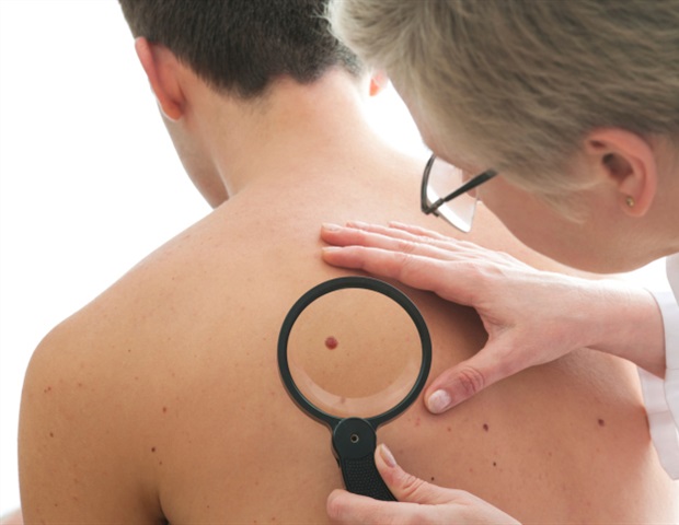 Targeting MARCO enhances cancer immunotherapy effectiveness