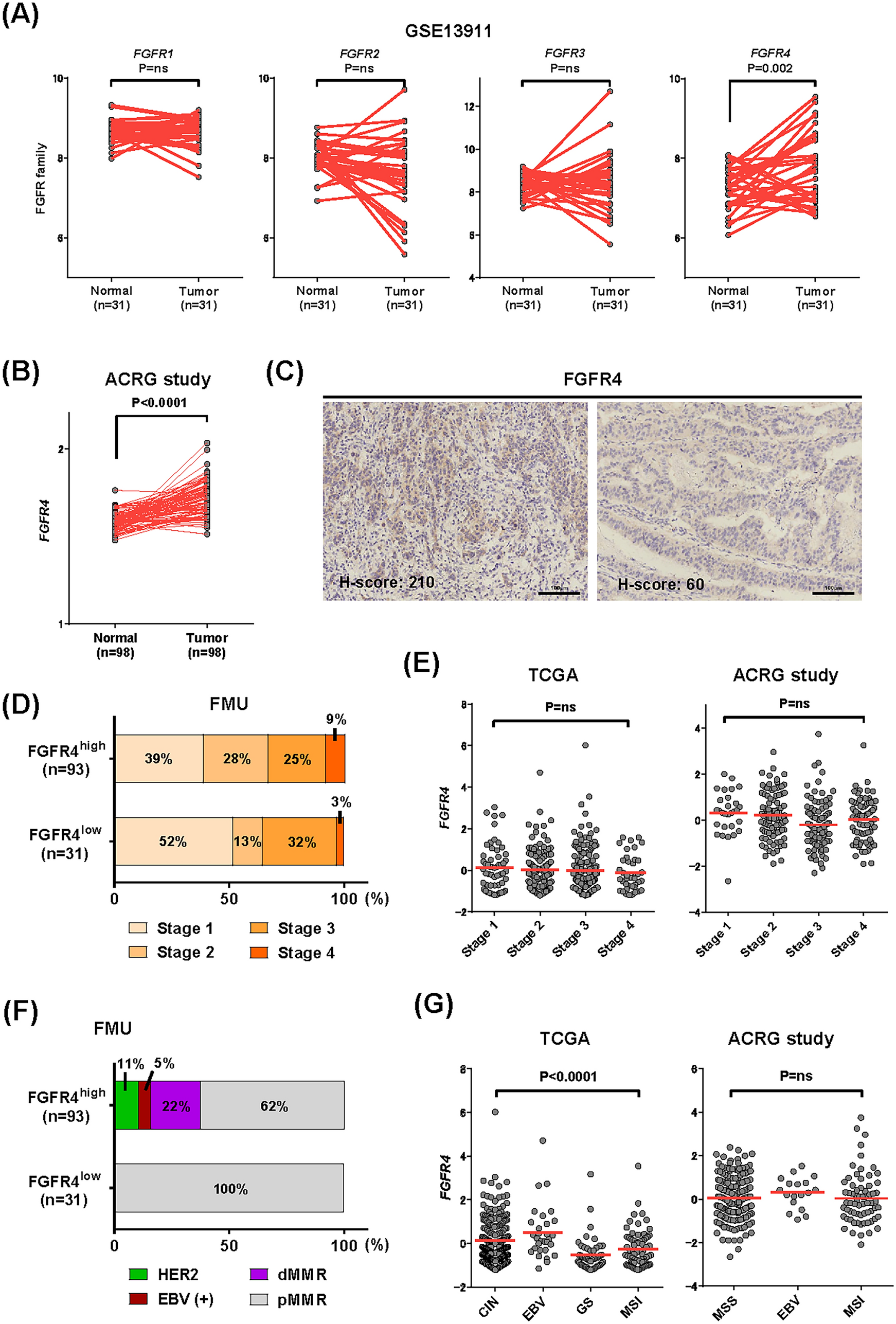 Lenvatinib suppress FGF19–FGFR4 signaling to enhance antitumor immune response in gastric cancer
