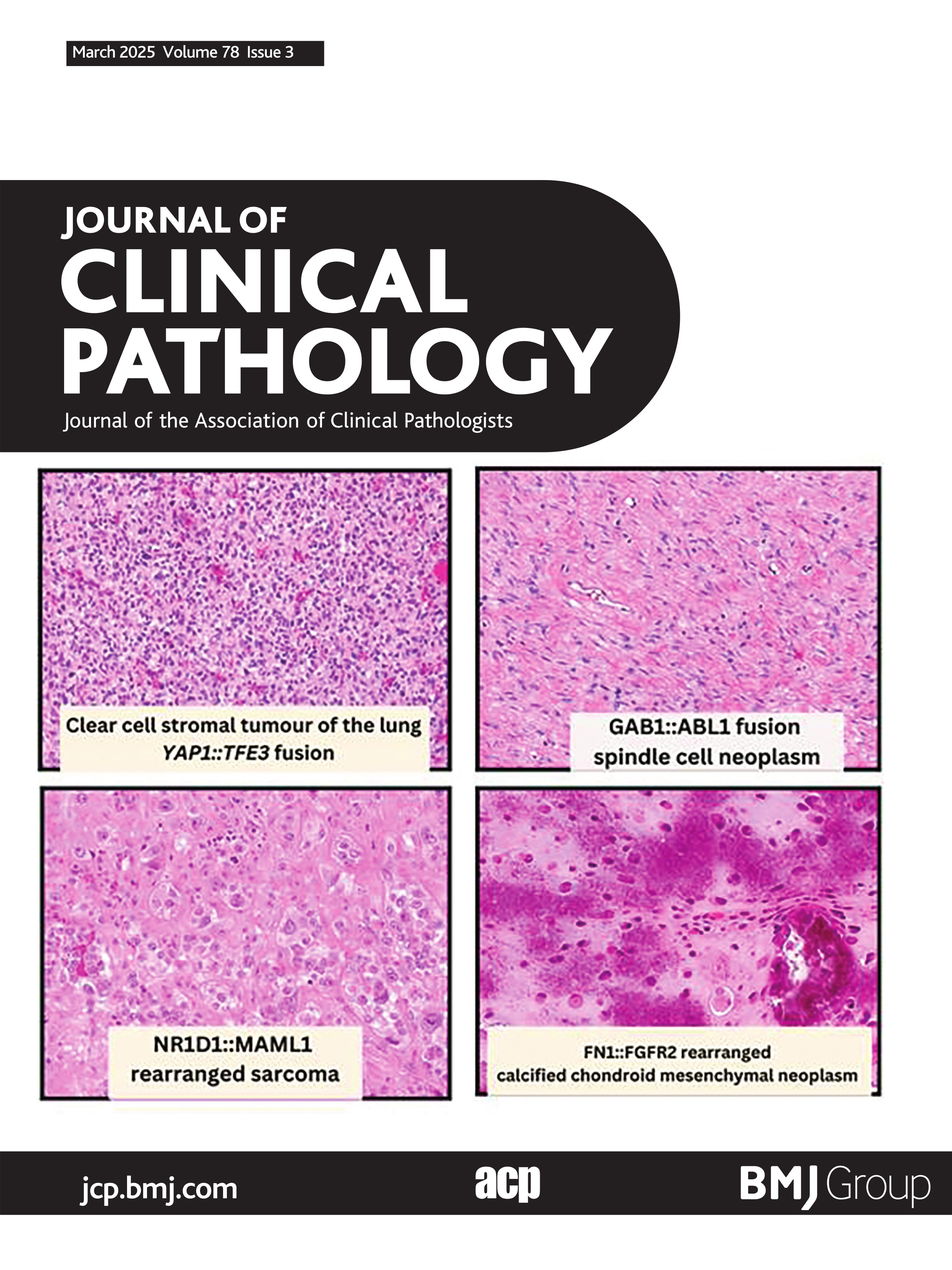 Clinicopathological characterisation of MTAP alterations in gastrointestinal cancers