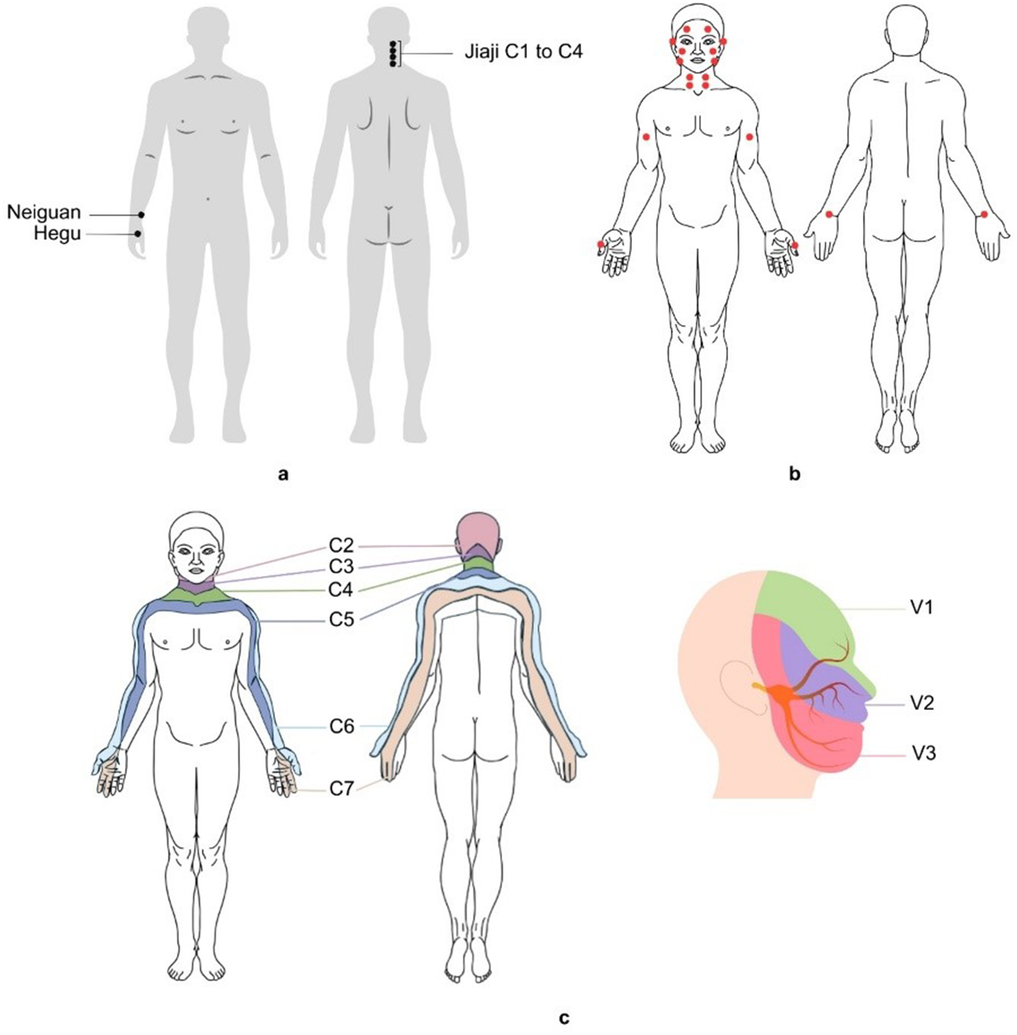 Enhanced pain threshold with the addition of neiguan and Hegu to cervical Jiaji electroacupuncture: a pre-post study