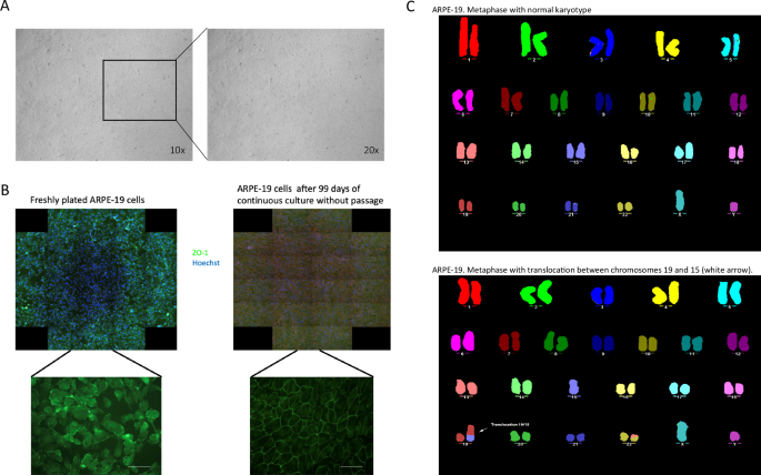 CRISPR targeting of SNPs associated with age-related macular degeneration in ARPE-19 cells: a potential model for manipulating the complement system