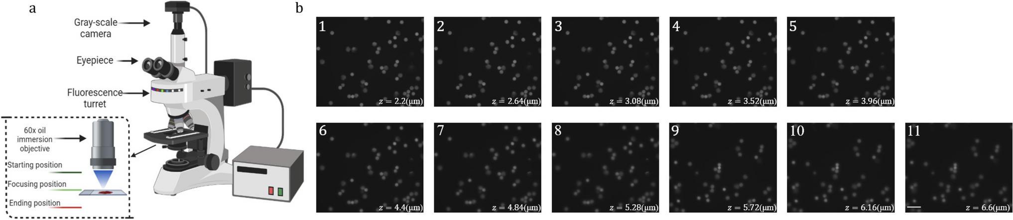 Chronic lymphocytic leukemia (CLL) screening and abnormality detection based on multi-layer fluorescence imaging signal enhancement and compensation