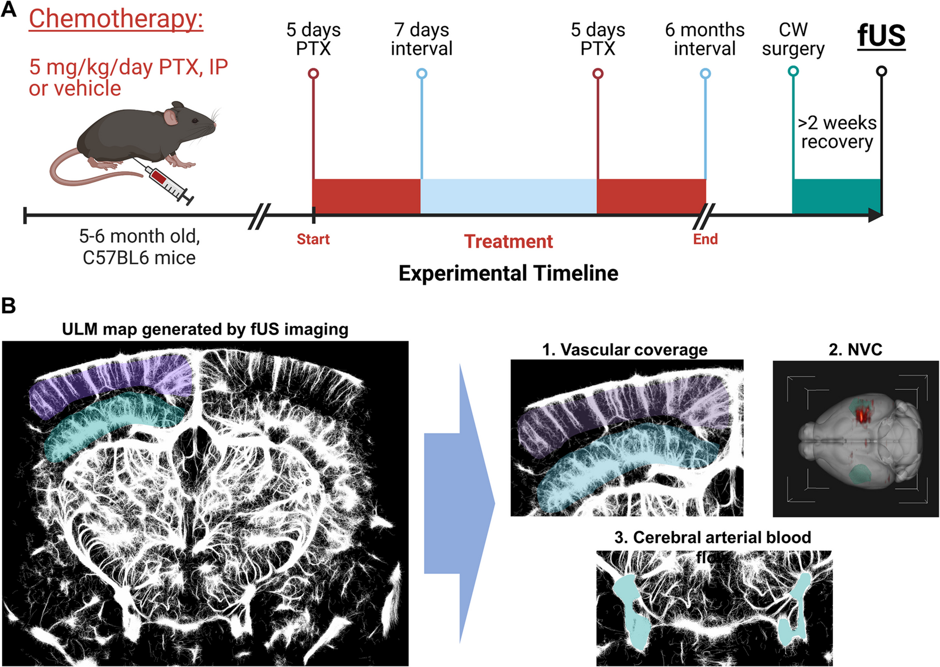 Functional ultrasound imaging reveals microvascular rarefaction, decreased cerebral blood flow, and impaired neurovascular coupling in a mouse model of paclitaxel-induced chemobrain