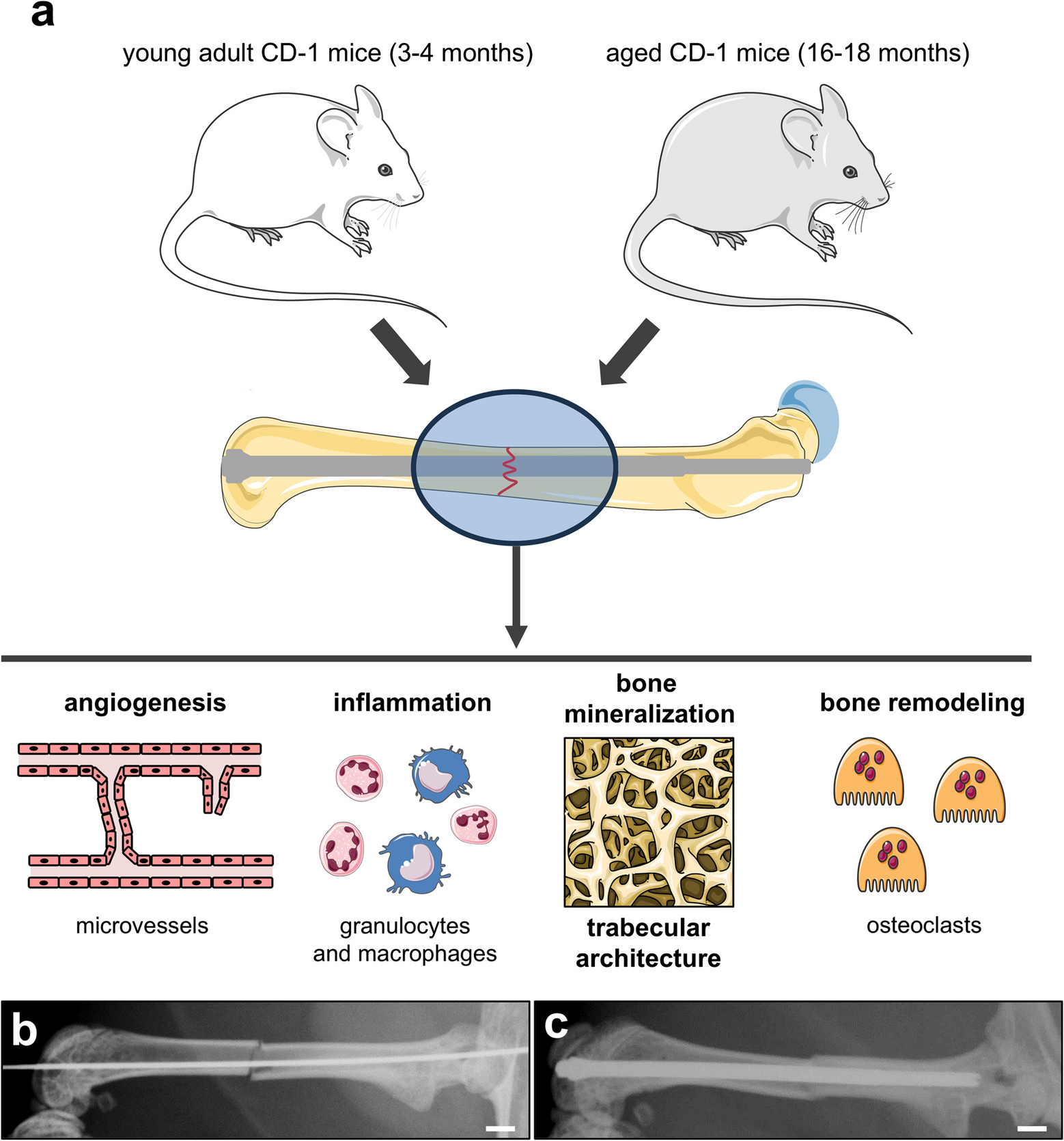 Age-related alterations of angiogenesis, inflammation and bone microarchitecture during fracture healing in mice