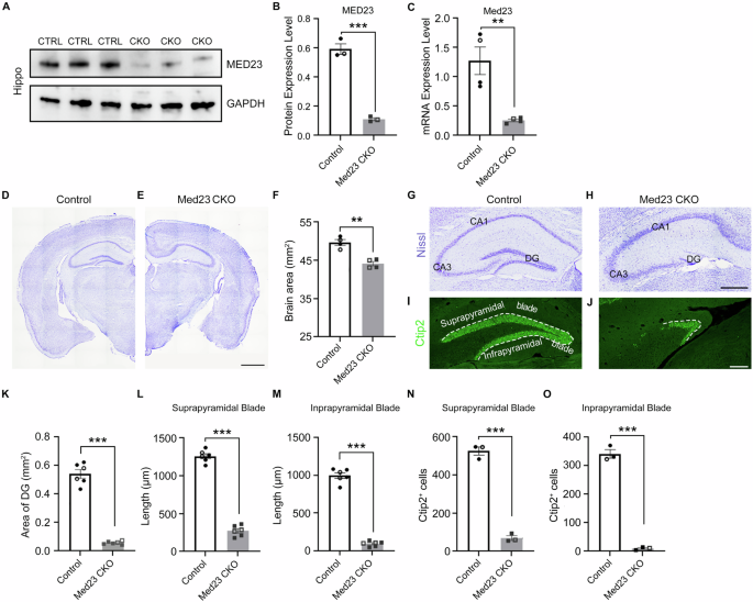 Central Med23 deficiency leads to malformation of dentate gyrus and ADHD-like behaviors in mice