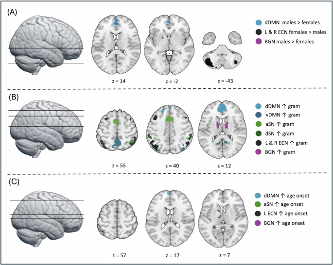 The role of sex in the association between cannabis use disorder and resting-state functional connectivity