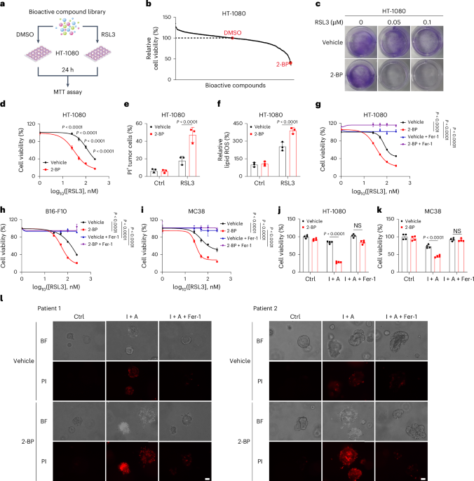 Palmitoylation of GPX4 via the targetable ZDHHC8 determines ferroptosis sensitivity and antitumor immunity