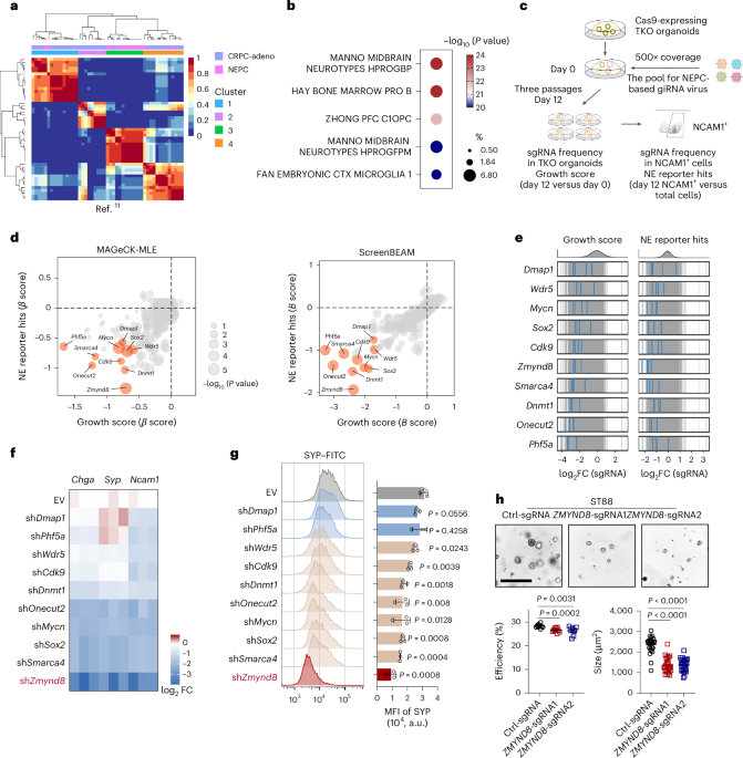 Targeting the histone reader ZMYND8 inhibits antiandrogen-induced neuroendocrine tumor transdifferentiation of prostate cancer