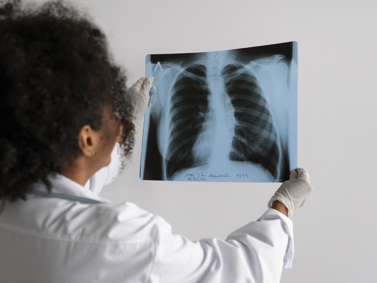 Lung Cancer Screening in Family Members and Peers of Patients With Lung Cancer: Protocol for a Prospective Cohort Study