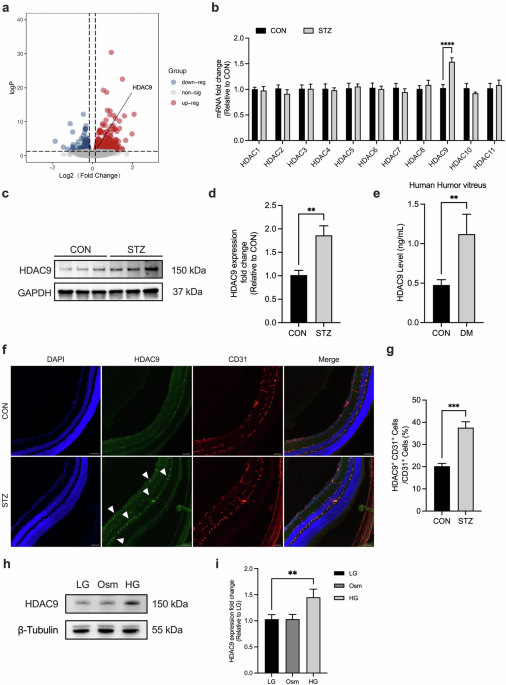 Endothelial histone deacetylase 9 promotes diabetic retinopathy in mice by regulating endothelial–mesenchymal transition